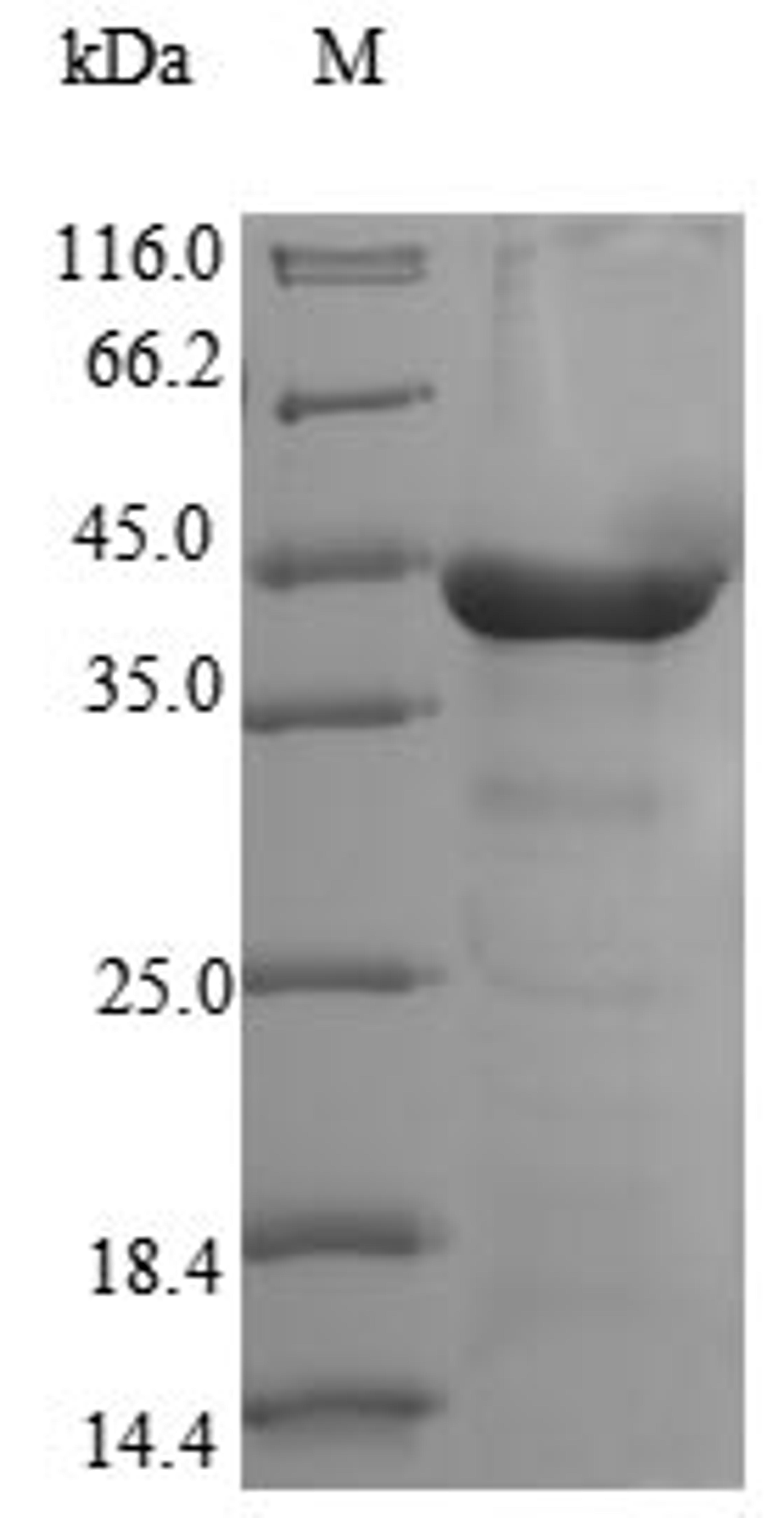 (Tris-Glycine gel) Discontinuous SDS-PAGE (reduced) with 5% enrichment gel and 15% separation gel.