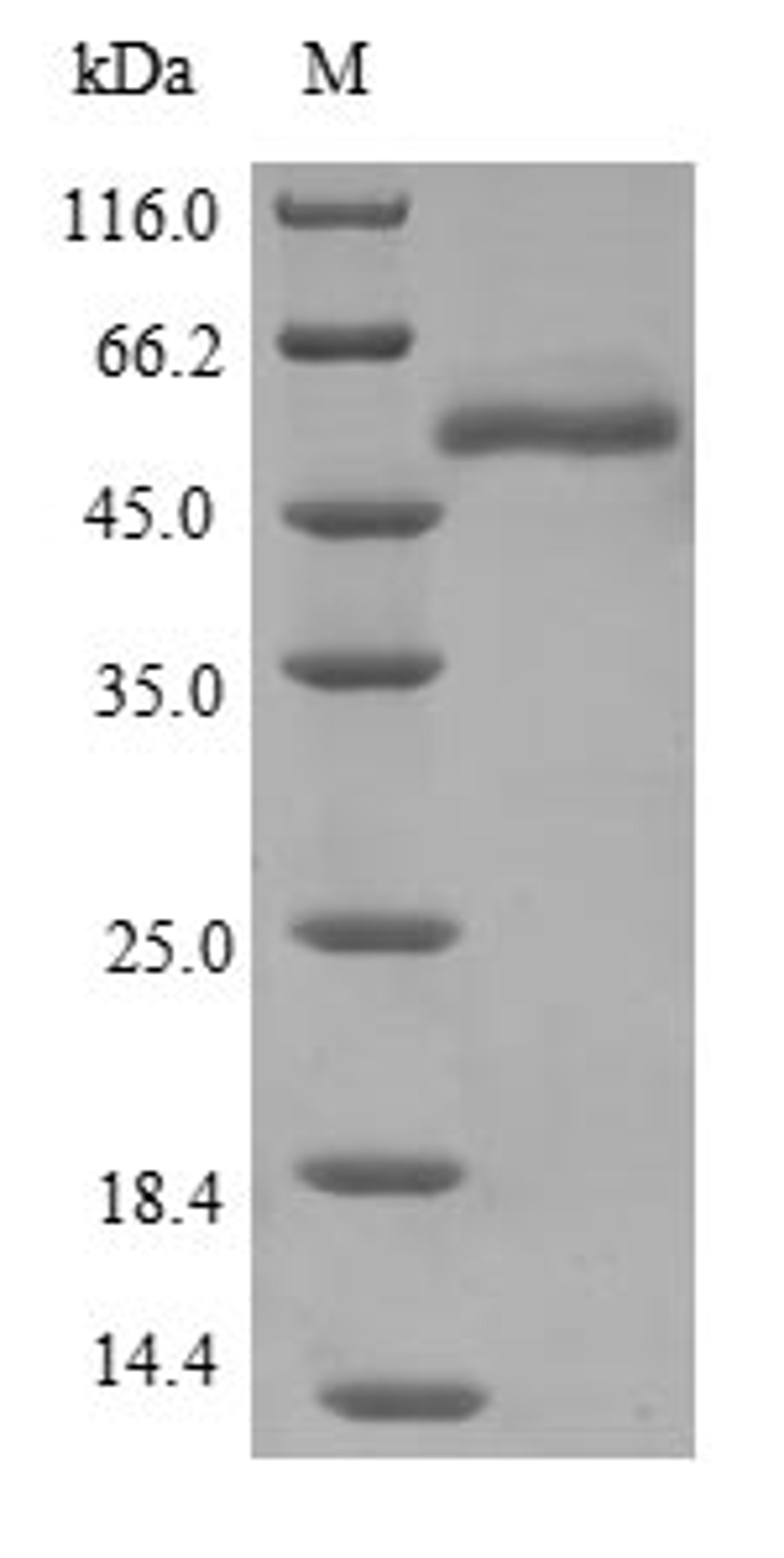 (Tris-Glycine gel) Discontinuous SDS-PAGE (reduced) with 5% enrichment gel and 15% separation gel.
