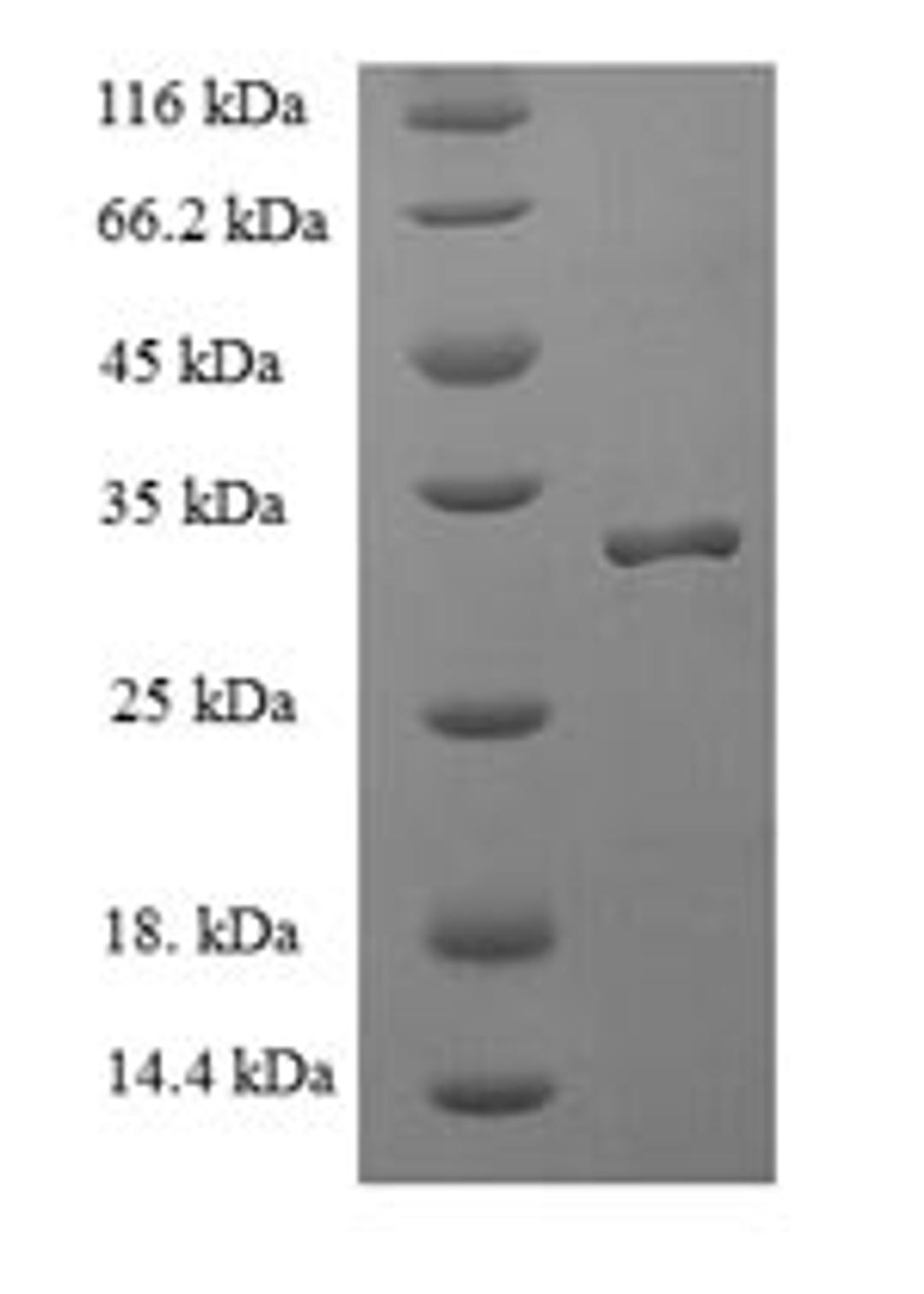 (Tris-Glycine gel) Discontinuous SDS-PAGE (reduced) with 5% enrichment gel and 15% separation gel.