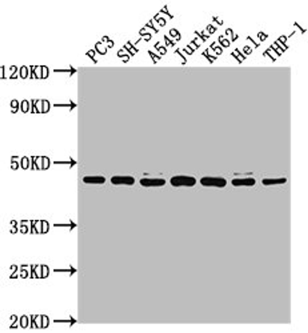 Western Blot. Positive WB detected in: PC3 whole cell lysate, SH-SY5Y whole cell lysate, A549 whole cell lysate, Jurkat whole cell lysate, K562 whole cell lysate, Hela whole cell lysate, THP-1 whole cell lysate. All lanes: CSNK2A3 antibody at 1:2000. Secondary. Goat polyclonal to rabbit IgG at 1/50000 dilution. Predicted band size: 46 kDa. Observed band size: 46 kDa