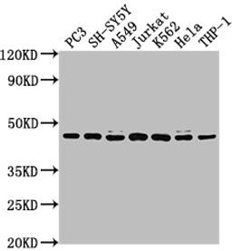 Western Blot. Positive WB detected in: PC3 whole cell lysate, SH-SY5Y whole cell lysate, A549 whole cell lysate, Jurkat whole cell lysate, K562 whole cell lysate, Hela whole cell lysate, THP-1 whole cell lysate. All lanes: CSNK2A3 antibody at 1:2000. Secondary. Goat polyclonal to rabbit IgG at 1/50000 dilution. Predicted band size: 46 kDa. Observed band size: 46 kDa