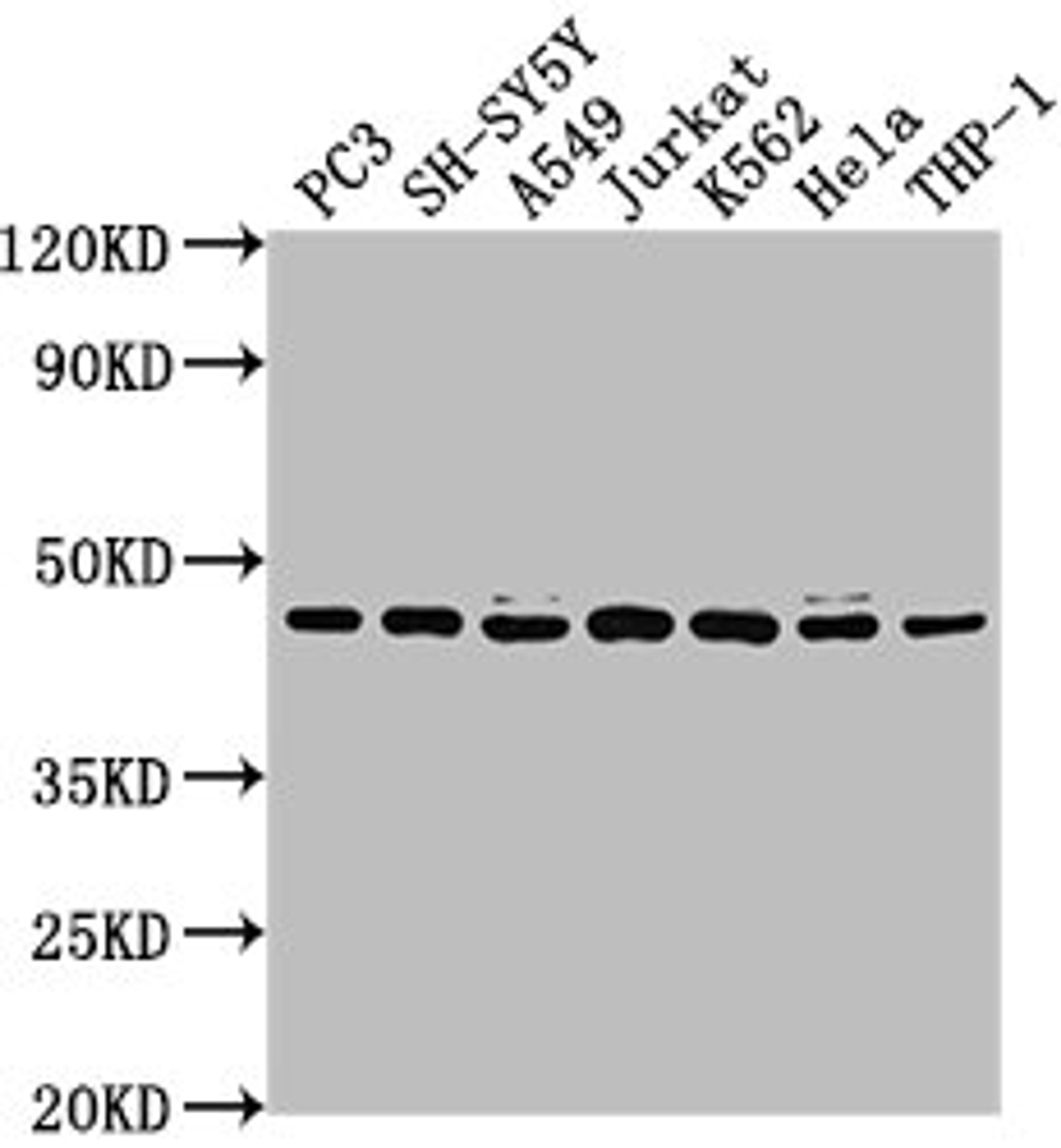 Western Blot. Positive WB detected in: PC3 whole cell lysate, SH-SY5Y whole cell lysate, A549 whole cell lysate, Jurkat whole cell lysate, K562 whole cell lysate, Hela whole cell lysate, THP-1 whole cell lysate. All lanes: CSNK2A3 antibody at 1:2000. Secondary. Goat polyclonal to rabbit IgG at 1/50000 dilution. Predicted band size: 46 kDa. Observed band size: 46 kDa