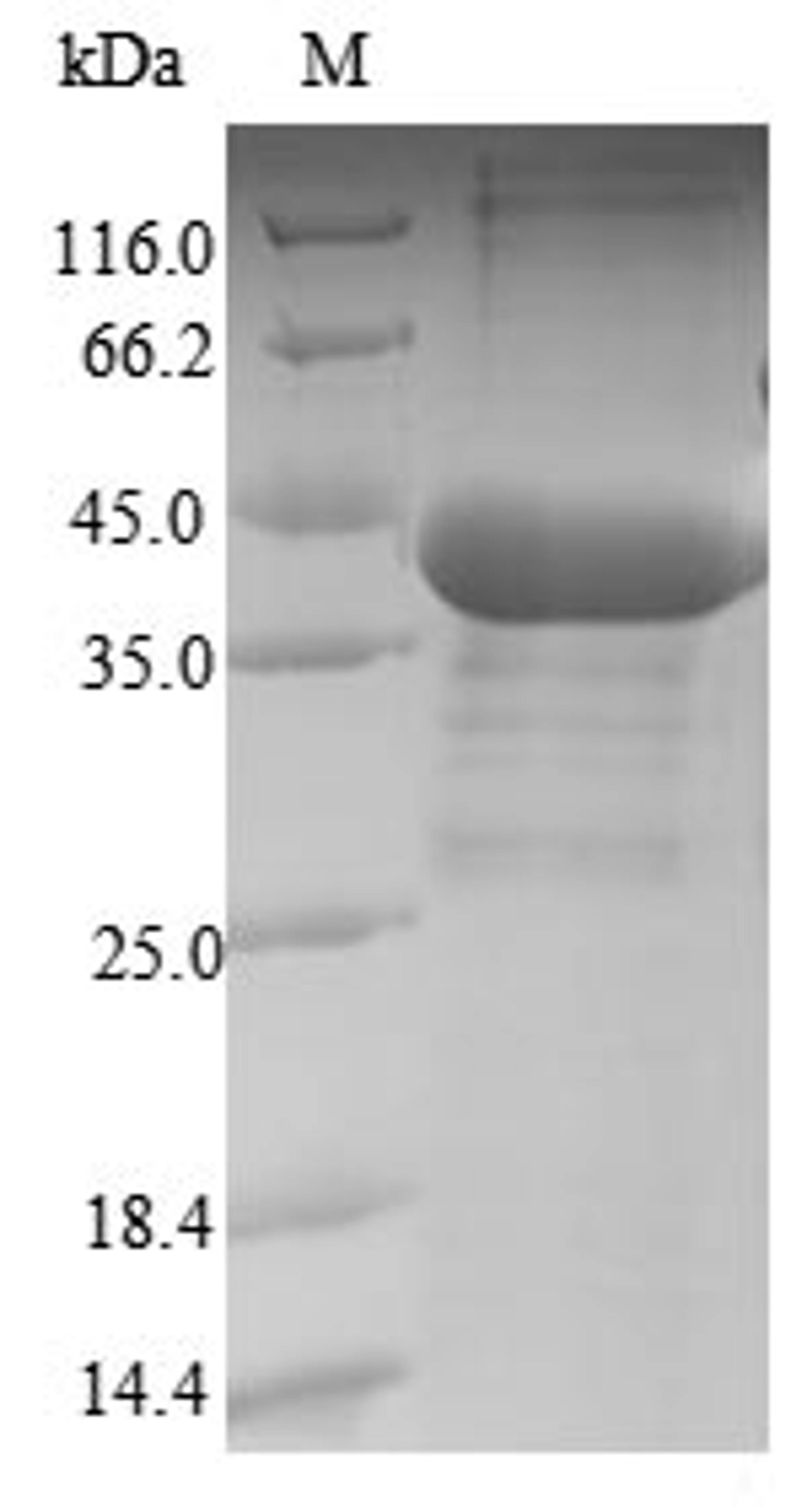 (Tris-Glycine gel) Discontinuous SDS-PAGE (reduced) with 5% enrichment gel and 15% separation gel.