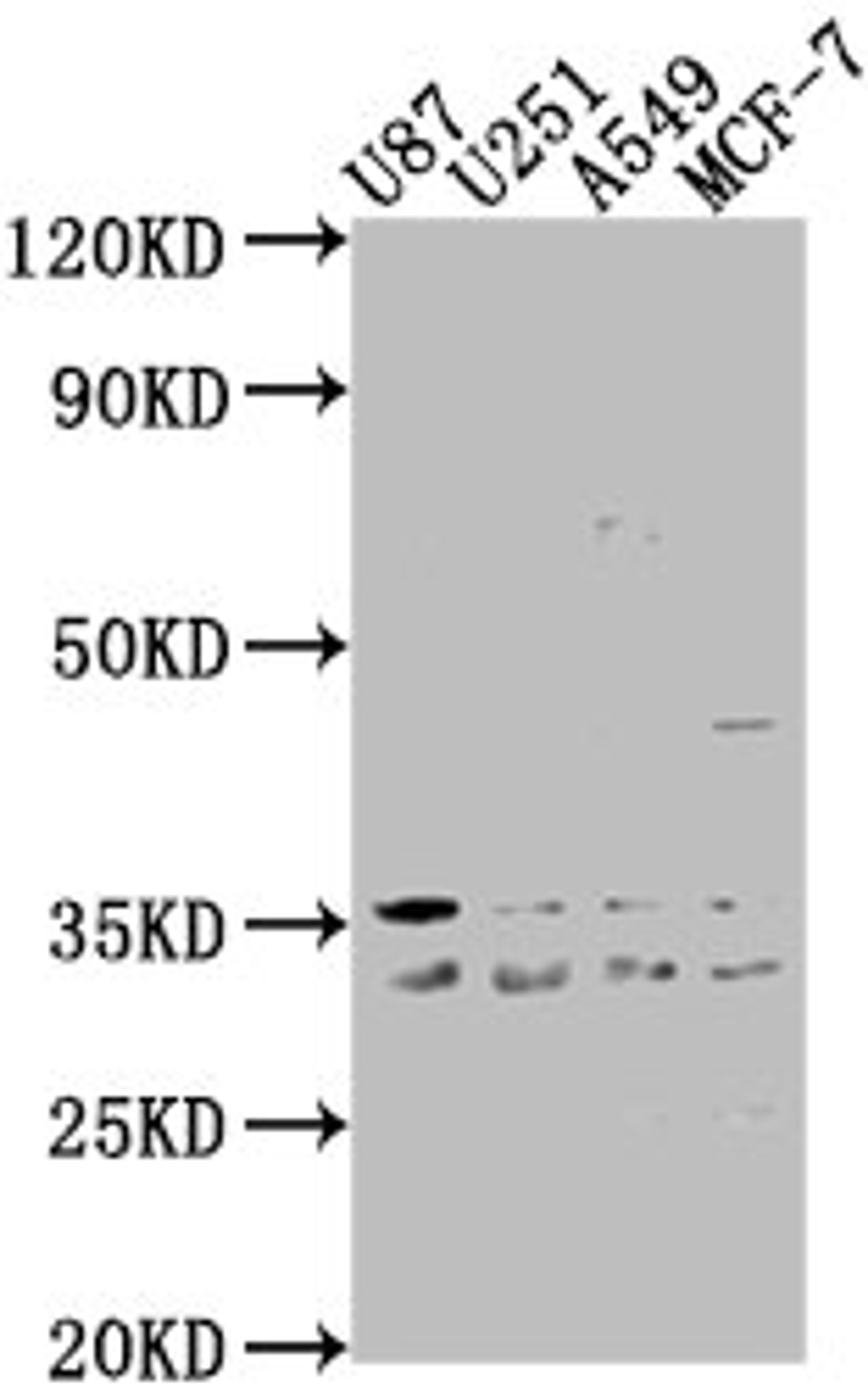 Western Blot. Positive WB detected in: U87 whole cell lysate, U251 whole cell lysate, A549 whole cell lysate, MCF-7 whole cell lysate. All lanes: ATP6V1D antibody at 1:2000. Secondary. Goat polyclonal to rabbit IgG at 1/50000 dilution. Predicted band size: 29 kDa. Observed band size: 29 kDa. 