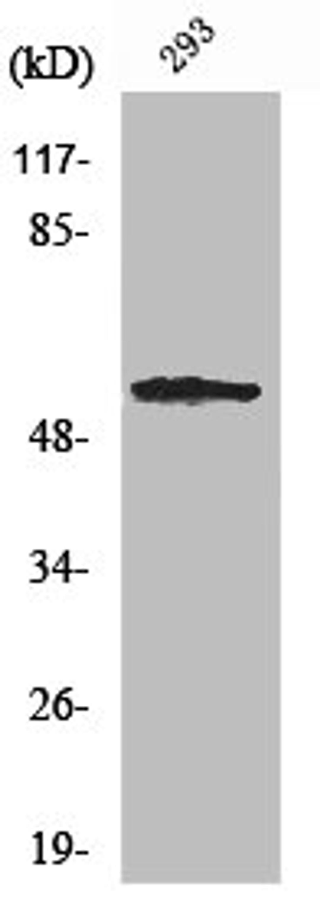 Western Blot analysis of 293 cells using SGK1 Polyclonal Antibody