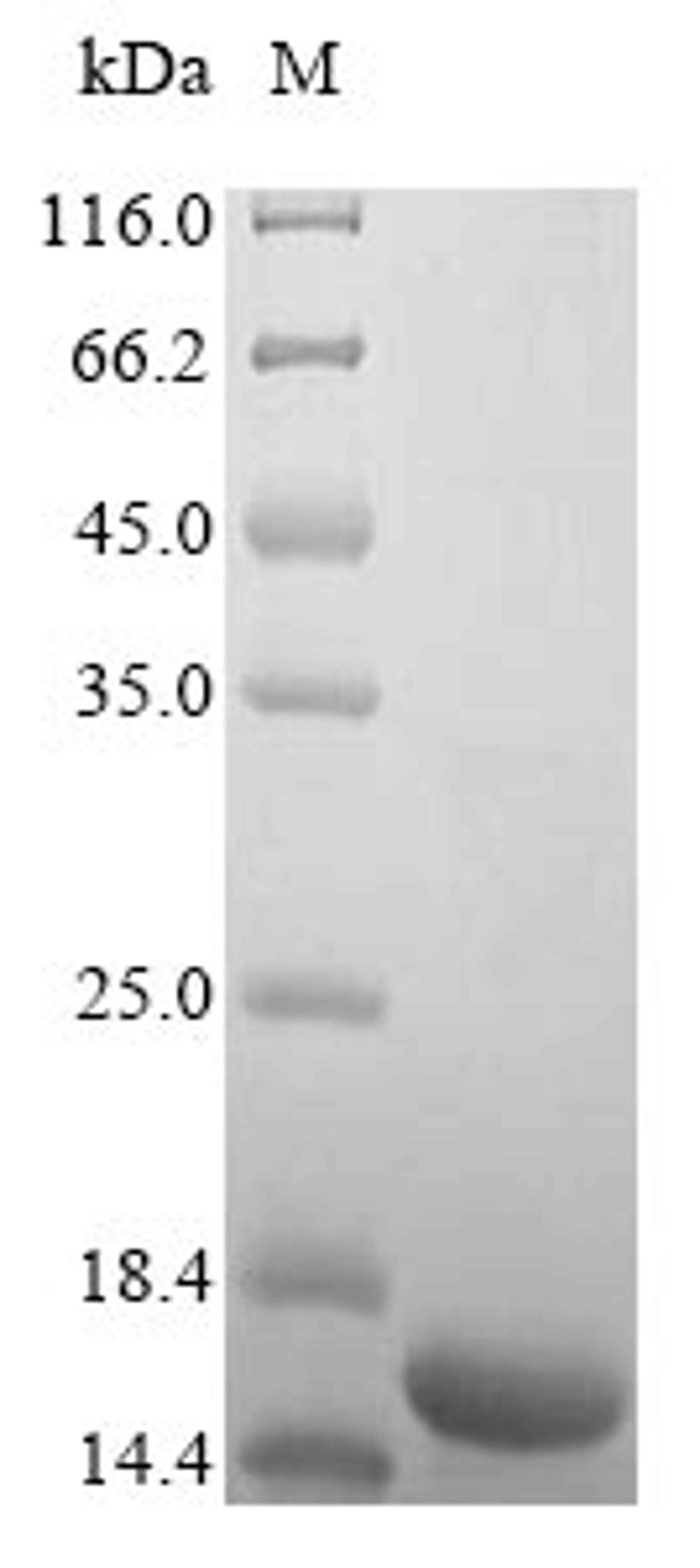 (Tris-Glycine gel) Discontinuous SDS-PAGE (reduced) with 5% enrichment gel and 15% separation gel.