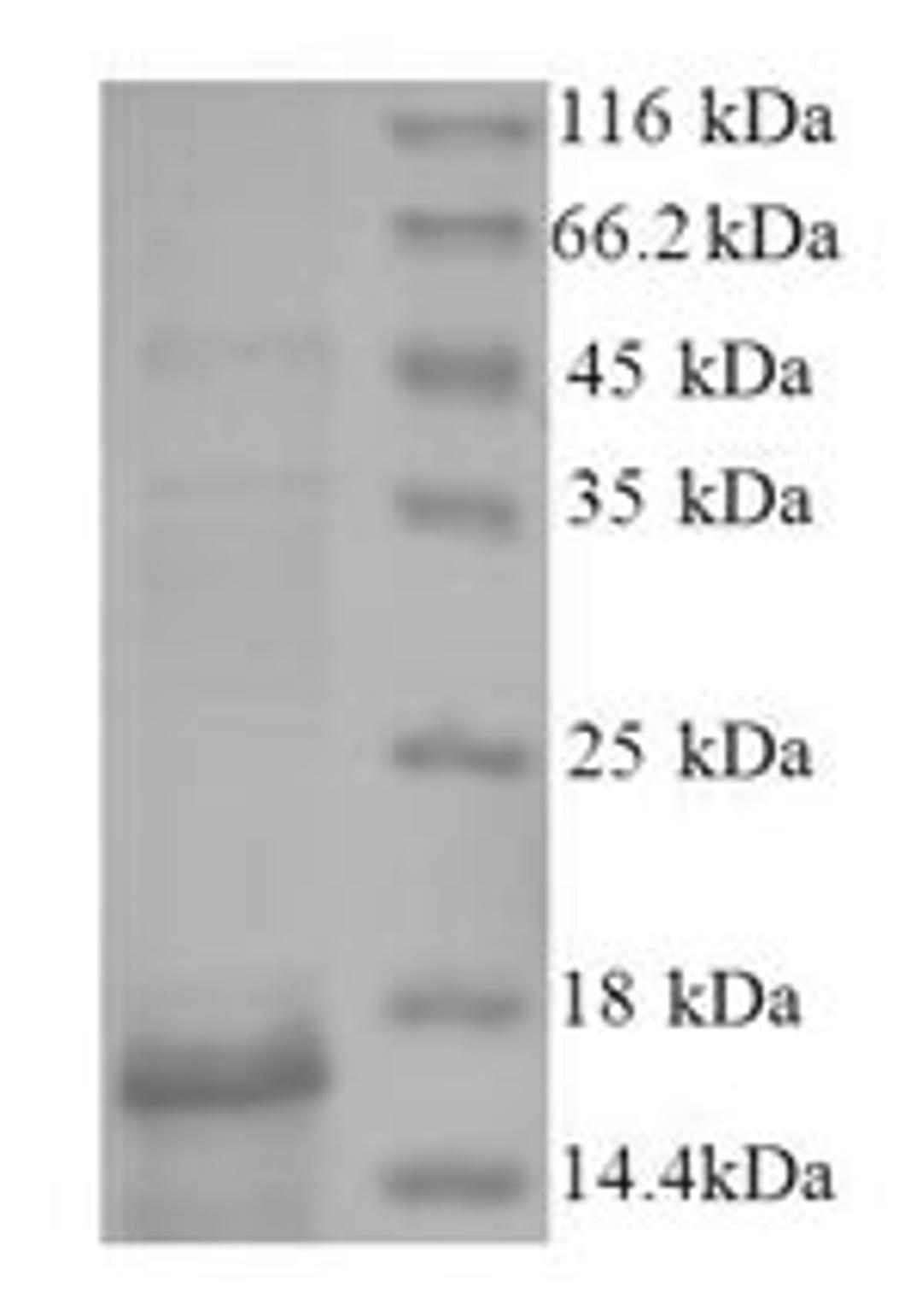 (Tris-Glycine gel) Discontinuous SDS-PAGE (reduced) with 5% enrichment gel and 15% separation gel.