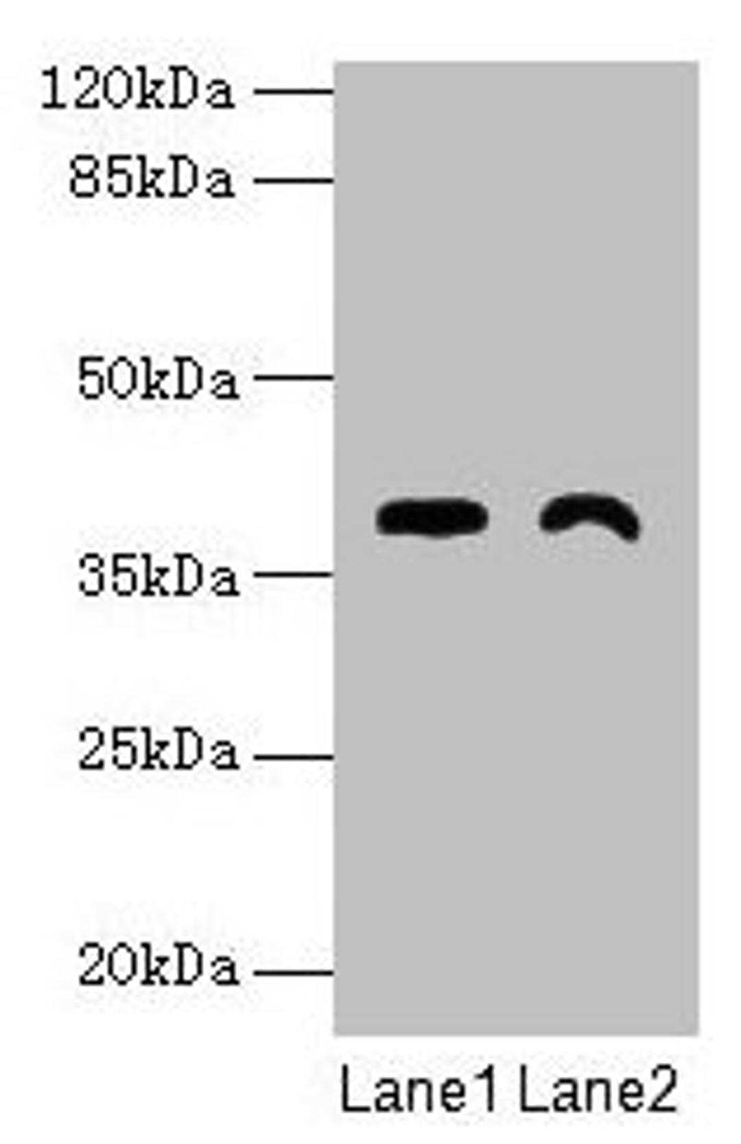 Western blot. All lanes: TMEM255A antibody at 6µg/ml. Lane 1: Mouse stomach tissue. Lane 2: Mouse heart tissue. Secondary. Goat polyclonal to rabbit IgG at 1/10000 dilution. Predicted band size: 39, 21, 36, 27 kDa. Observed band size: 39 kDa