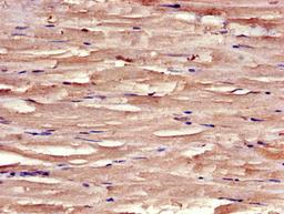 Immunohistochemistry of paraffin-embedded human skeletal muscle tissue using CSB-PA023019LA01HU at dilution of 1:100