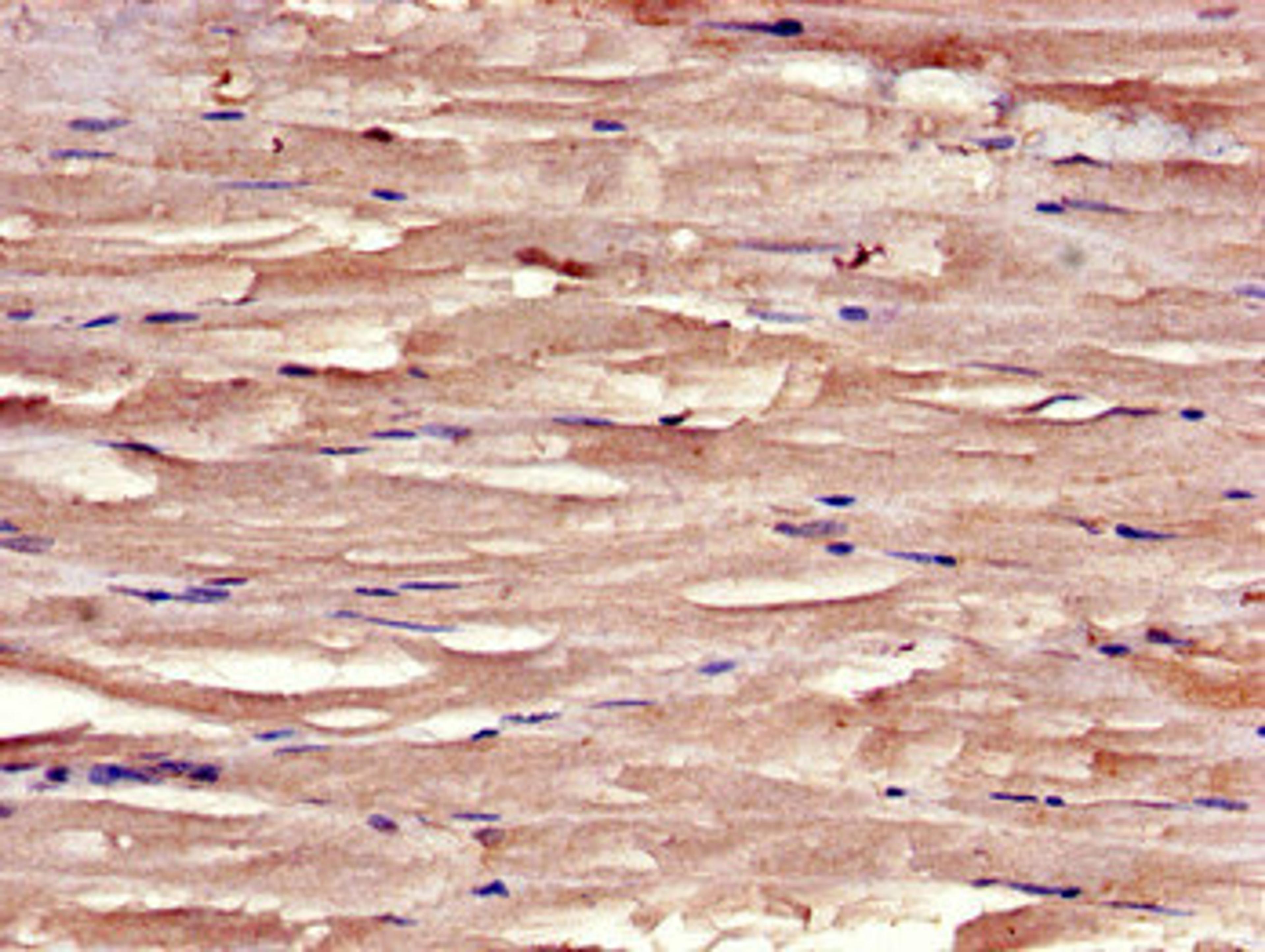 Immunohistochemistry of paraffin-embedded human skeletal muscle tissue using CSB-PA023019LA01HU at dilution of 1:100
