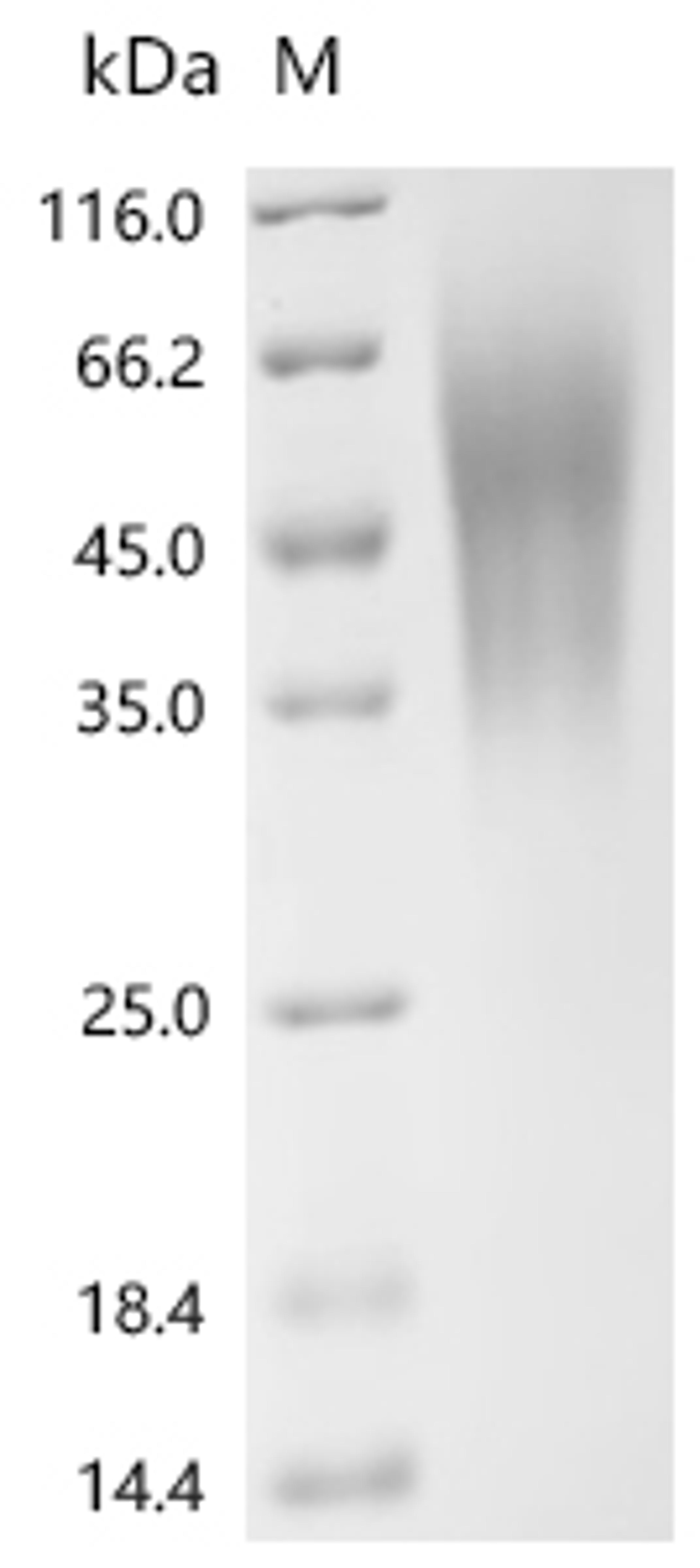 (Tris-Glycine gel) Discontinuous SDS-PAGE (reduced) with 5% enrichment gel and 15% separation gel.