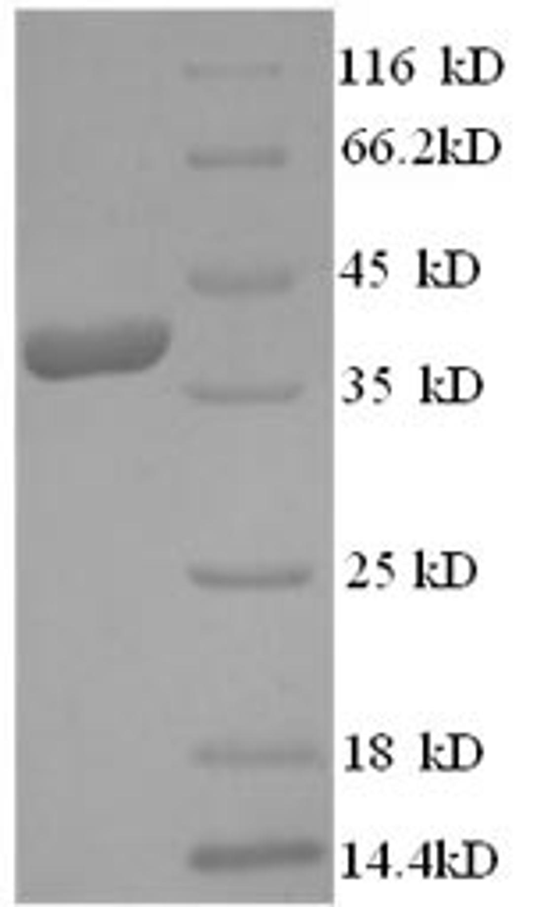 (Tris-Glycine gel) Discontinuous SDS-PAGE (reduced) with 5% enrichment gel and 15% separation gel.