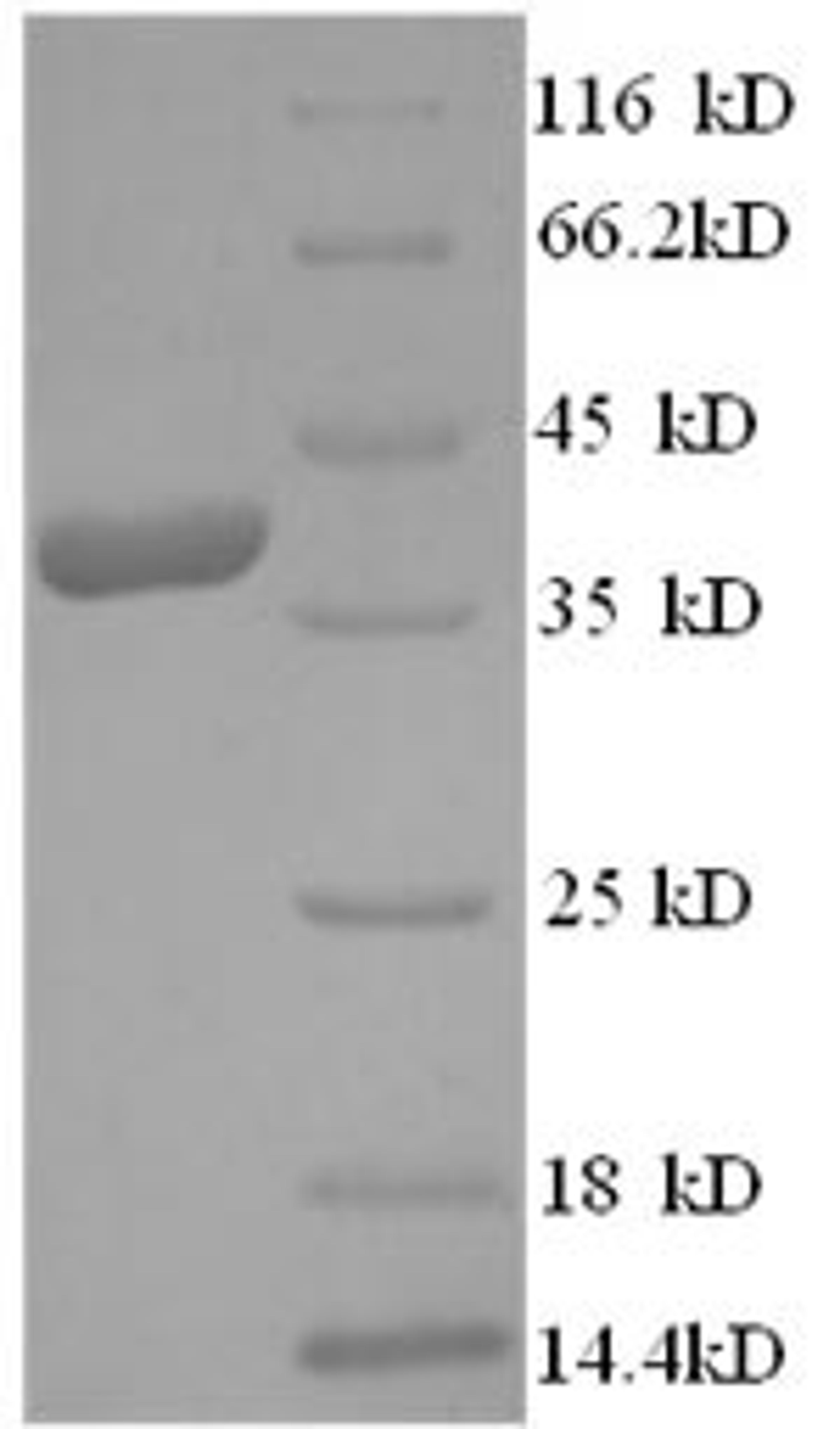 (Tris-Glycine gel) Discontinuous SDS-PAGE (reduced) with 5% enrichment gel and 15% separation gel.