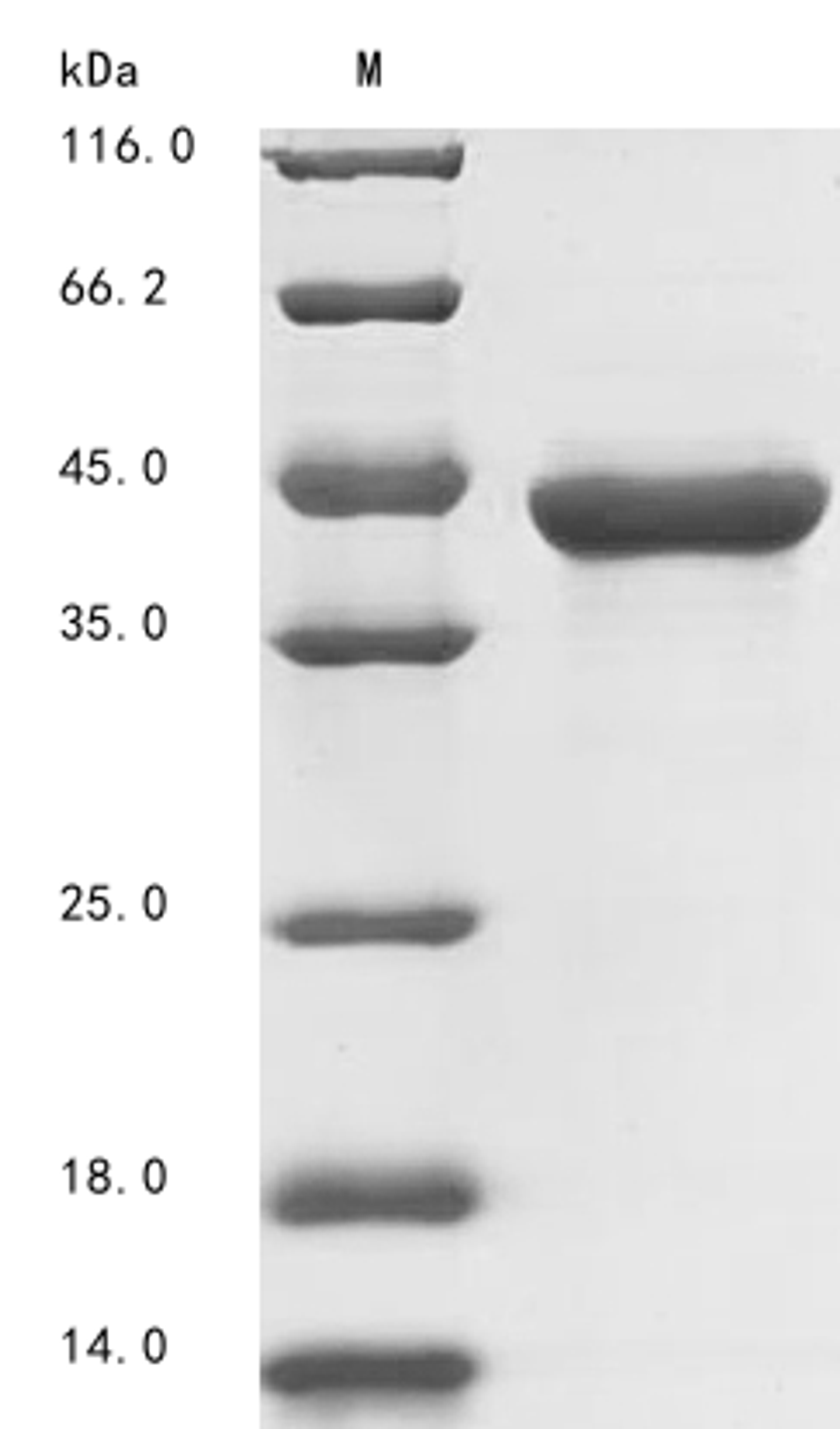 (Tris-Glycine gel) Discontinuous SDS-PAGE (reduced) with 5% enrichment gel and 15% separation gel.