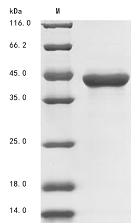 (Tris-Glycine gel) Discontinuous SDS-PAGE (reduced) with 5% enrichment gel and 15% separation gel.