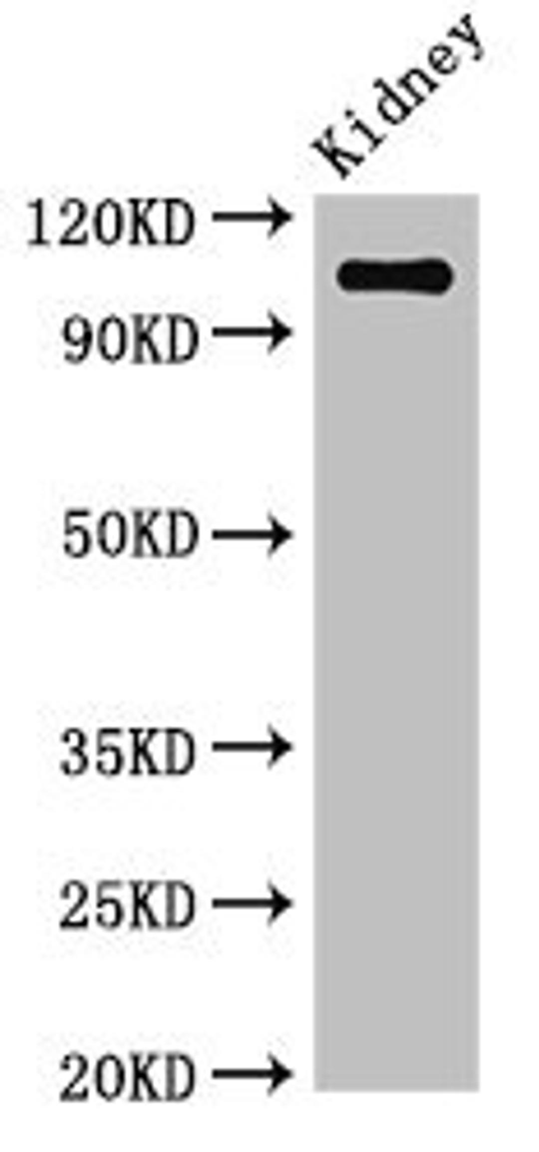 Western Blot. Positive WB detected in: Mouse kidney tissue. All lanes: ANPEP antibody at 3.4µg/ml. Secondary. Goat polyclonal to rabbit IgG at 1/50000 dilution. Predicted band size: 110 kDa. Observed band size: 110 kDa