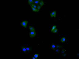 Immunofluorescence staining of Hela cell with CSB-RA022397MA1HU at 1:20,  counter-stained with DAPI. The cells were fixed in 4% formaldehyde and blocked in 10% normal Goat Serum. The cells were then incubated with the antibody overnight at 4C. The secondary antibody was FITC-conjugated AffiniPure Goat Anti-Mouse IgG(H+L).