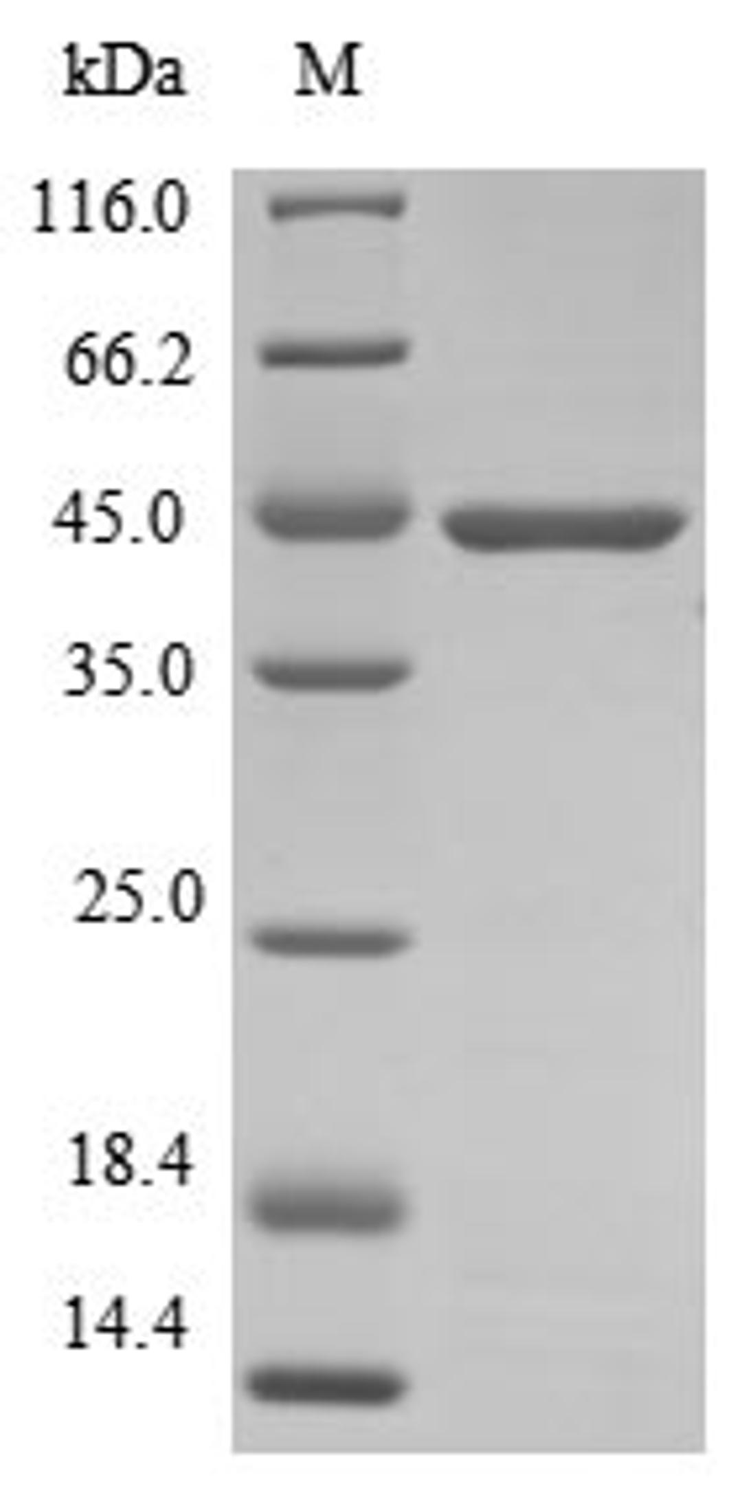 (Tris-Glycine gel) Discontinuous SDS-PAGE (reduced) with 5% enrichment gel and 15% separation gel.