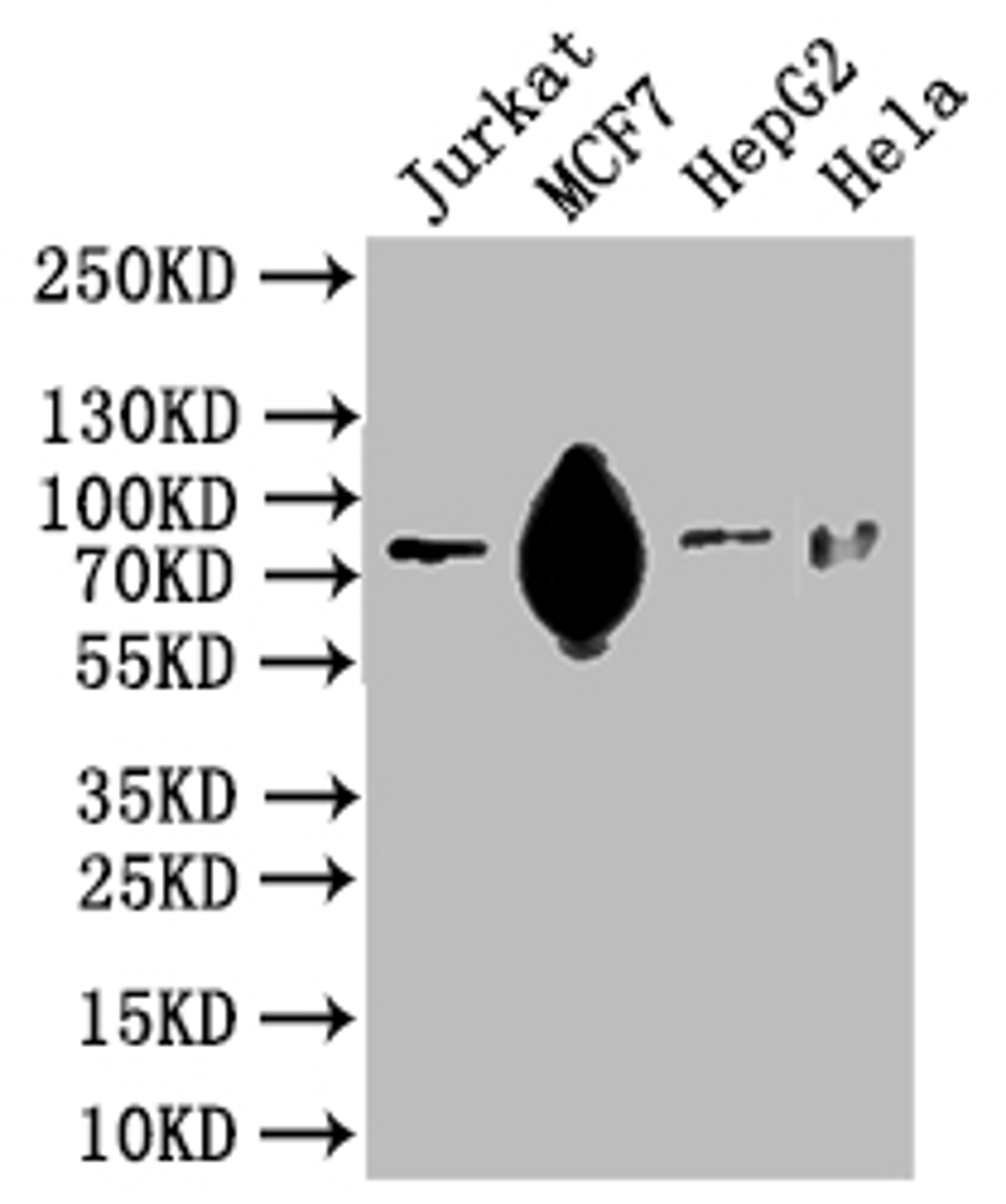 Western Blot. Positive WB detected in: Hela whole cell lysate, HEK293 whole cell lysate, MCF-7 whole cell lysate. All lanes: SLC20A1 antibody at 2.5µg/ml. Secondary. Goat polyclonal to rabbit IgG at 1/50000 dilution. Predicted band size: 74 kDa. Observed band size: 74 kDa