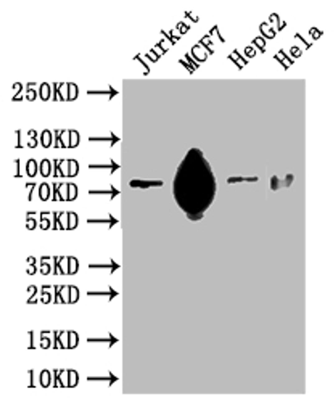 Western Blot. Positive WB detected in: Hela whole cell lysate, HEK293 whole cell lysate, MCF-7 whole cell lysate. All lanes: SLC20A1 antibody at 2.5µg/ml. Secondary. Goat polyclonal to rabbit IgG at 1/50000 dilution. Predicted band size: 74 kDa. Observed band size: 74 kDa
