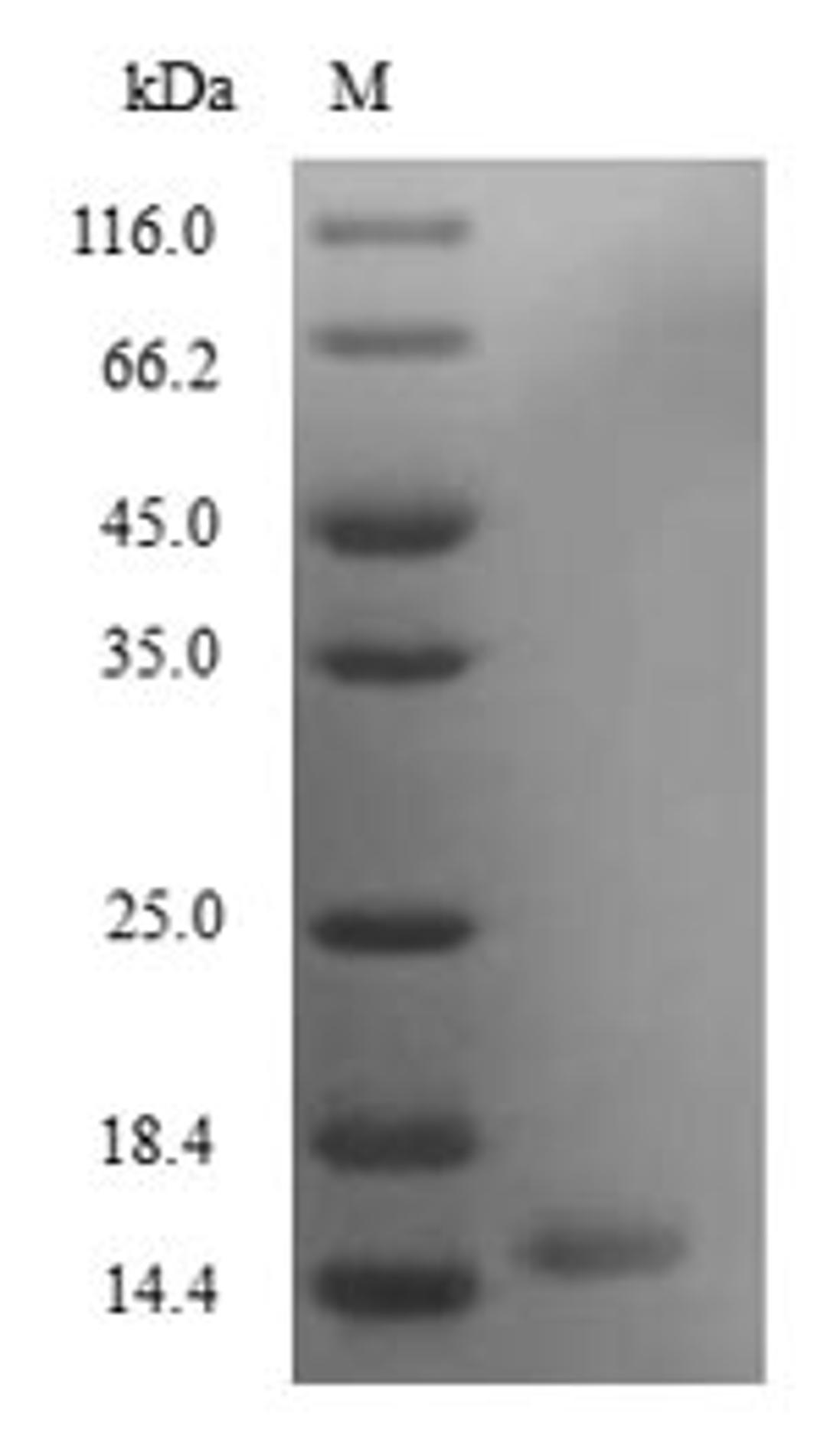 (Tris-Glycine gel) Discontinuous SDS-PAGE (reduced) with 5% enrichment gel and 15% separation gel.