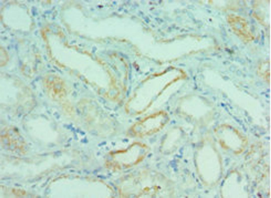 Immunohistochemistry of paraffin-embedded human kidney tissue using CSB-PA888000ESR1HU at dilution of 1:100