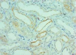 Immunohistochemistry of paraffin-embedded human kidney tissue using CSB-PA888000ESR1HU at dilution of 1:100