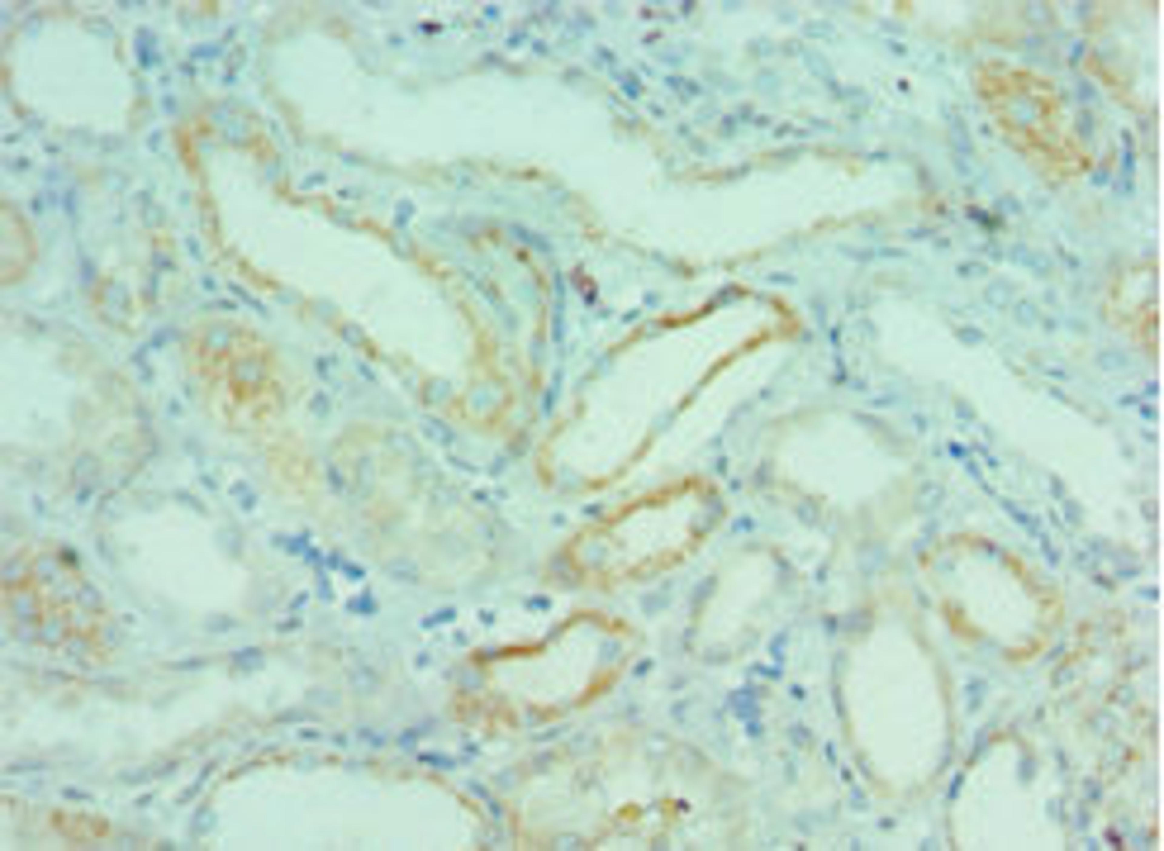 Immunohistochemistry of paraffin-embedded human kidney tissue using CSB-PA888000ESR1HU at dilution of 1:100