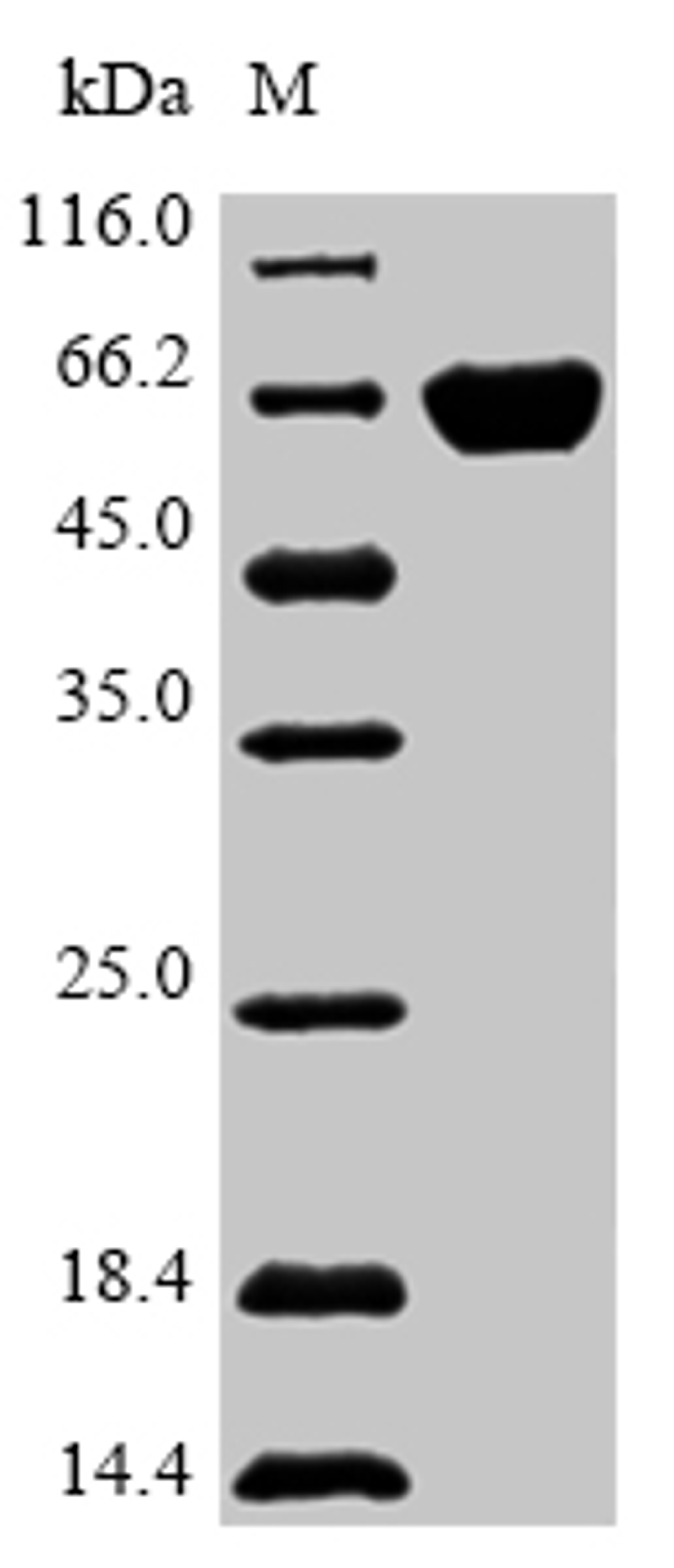 (Tris-Glycine gel) Discontinuous SDS-PAGE (reduced) with 5% enrichment gel and 15% separation gel.