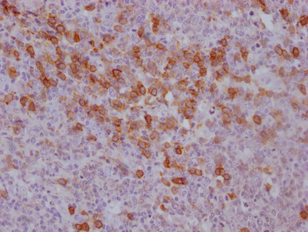 IHC image of CSB-MA785760 diluted at 1:100 and staining in paraffin-embedded human tonsil tissue performed on a Leica BondTM system. After dewaxing and hydration, antigen retrieval was mediated by high pressure in a citrate buffer (pH 6.0). Section was blocked with 10% normal goat serum 30min at RT. Then primary antibody (1% BSA) was incubated at 4°C overnight. The primary is detected by a Goat anti-mouse IgG polymer labeled by HRP and visualized using 0.05% DAB.