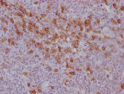 IHC image of CSB-MA785760 diluted at 1:100 and staining in paraffin-embedded human tonsil tissue performed on a Leica BondTM system. After dewaxing and hydration, antigen retrieval was mediated by high pressure in a citrate buffer (pH 6.0). Section was blocked with 10% normal goat serum 30min at RT. Then primary antibody (1% BSA) was incubated at 4°C overnight. The primary is detected by a Goat anti-mouse IgG polymer labeled by HRP and visualized using 0.05% DAB.