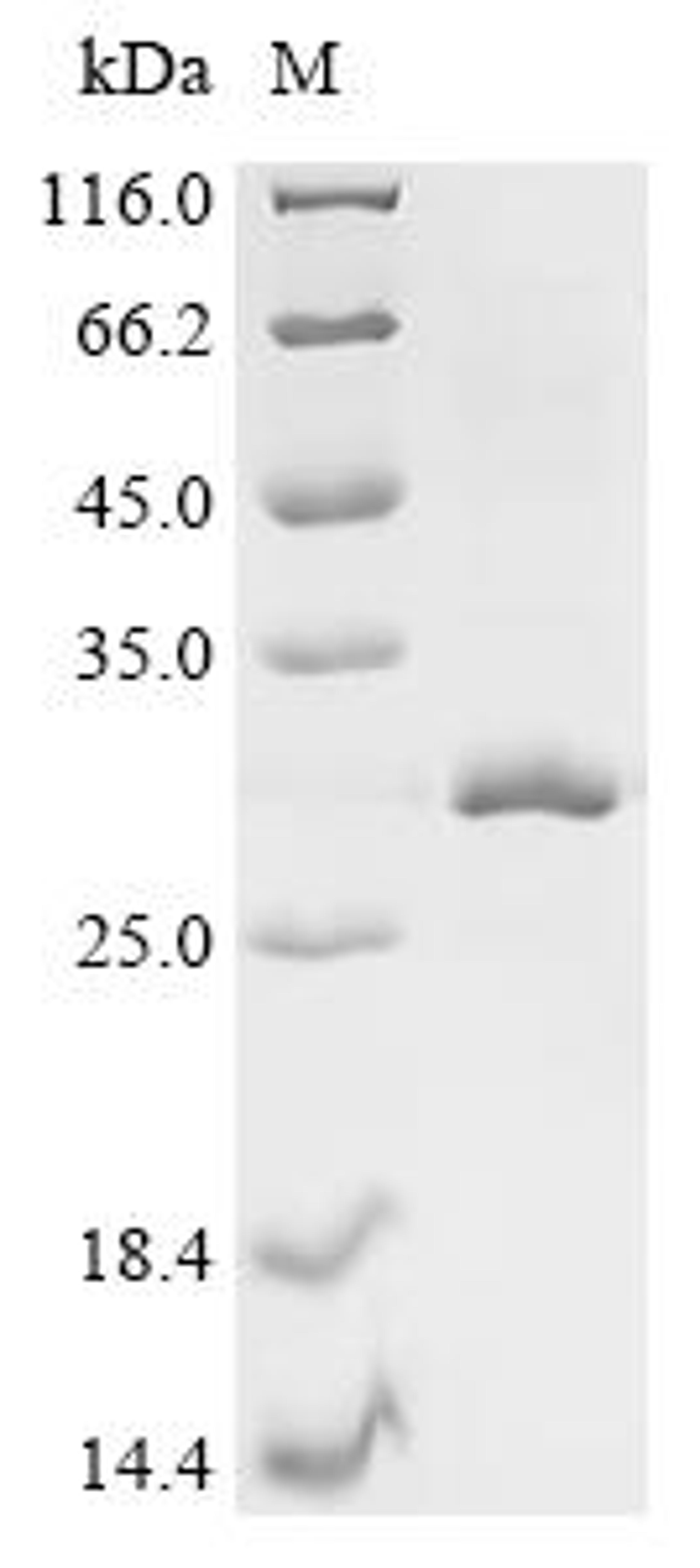 (Tris-Glycine gel) Discontinuous SDS-PAGE (reduced) with 5% enrichment gel and 15% separation gel.