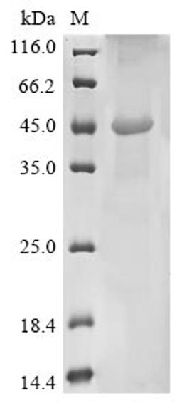 (Tris-Glycine gel) Discontinuous SDS-PAGE (reduced) with 5% enrichment gel and 15% separation gel.