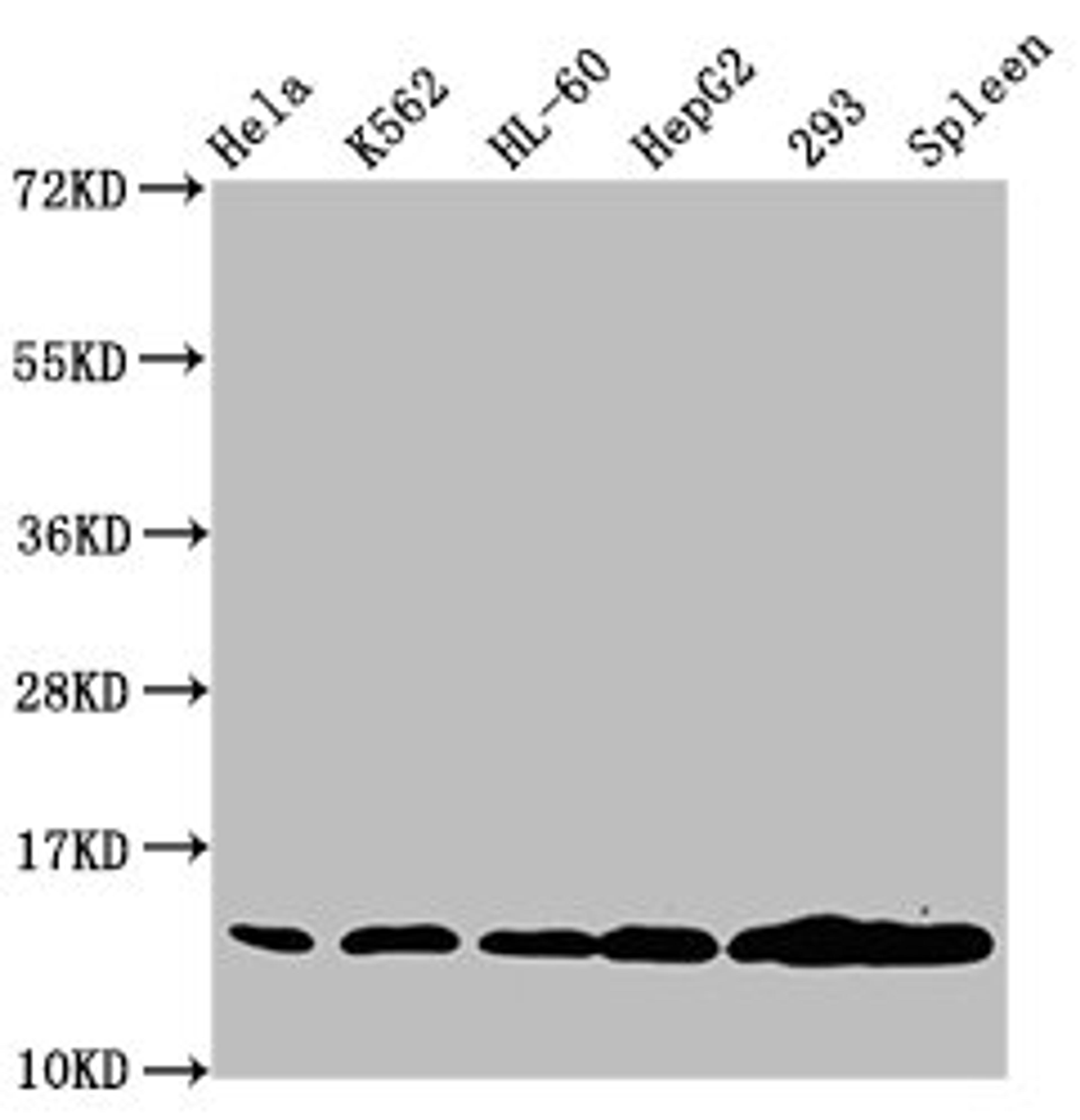 Western Blot. Positive WB detected in: Hela whole cell lysate, K562 whole cell lysate, HL60 whole cell lysate, HepG2 whole cell lysate, 293 whole cell lysate, Rat spleen tissue. All lanes: HIST1H2BC antibody at 1.3µg/ml. Secondary. Goat polyclonal to rabbit IgG at 1/50000 dilution. Predicted band size: 14 kDa. Observed band size: 14 kDa
