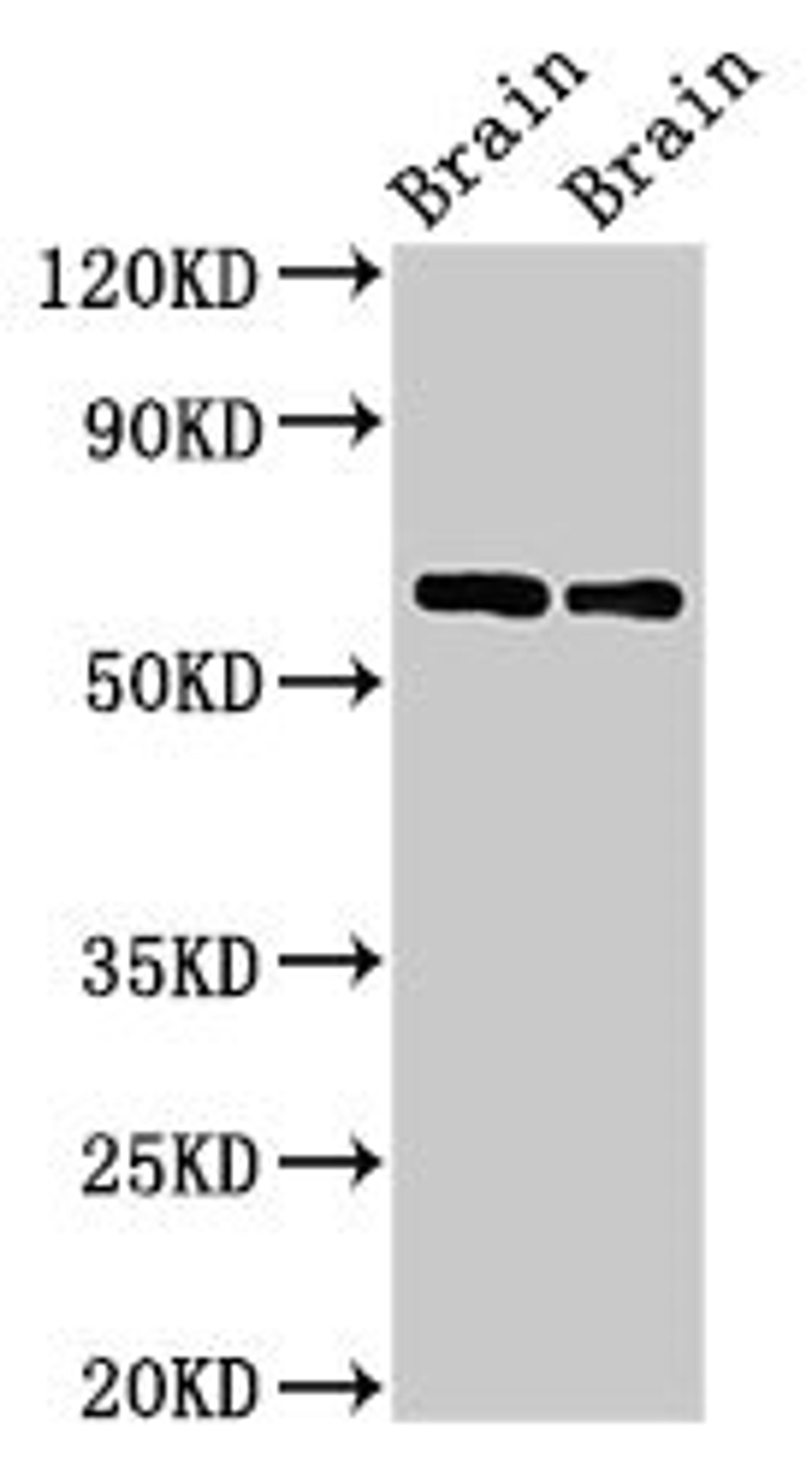 Western Blot. Positive WB detected in: Rat brain tissue, Mouse brain tissue. All lanes: CPNE4 antibody at 2ug/ml. Secondary. Goat polyclonal to rabbit IgG at 1/50000 dilution. Predicted band size: 63, 65 kDa. Observed band size: 63 kDa.