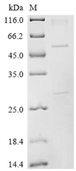 (Tris-Glycine gel) Discontinuous SDS-PAGE (reduced) with 5% enrichment gel and 15% separation gel.