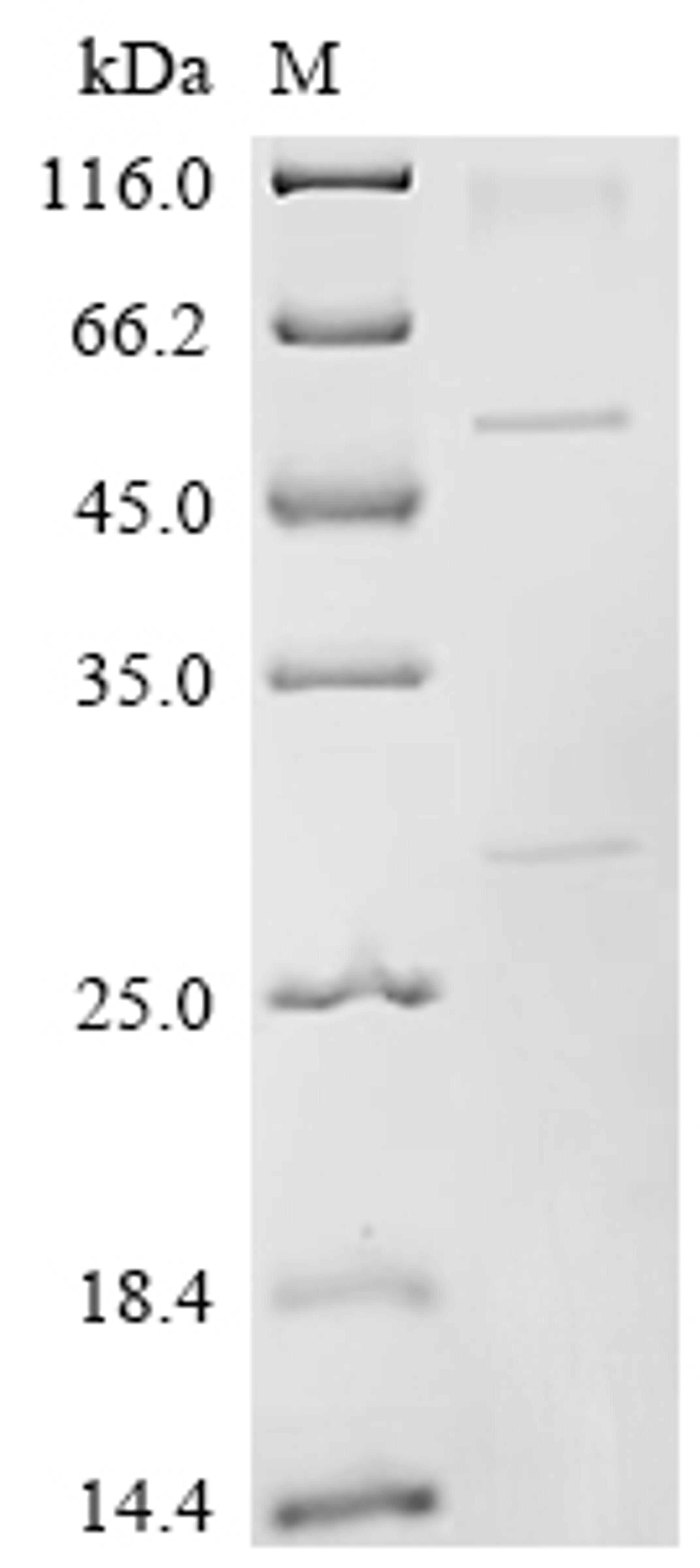 (Tris-Glycine gel) Discontinuous SDS-PAGE (reduced) with 5% enrichment gel and 15% separation gel.