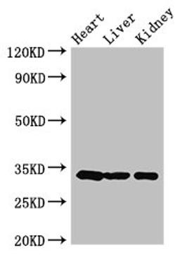 Western Blot. Positive WB detected in: Mouse heart tissue, Mouse liver tissue, Mouse kidney tissue. All lanes: CCND2 antibody at 3.5ug/ml. Secondary. Goat polyclonal to rabbit IgG at 1/50000 dilution. Predicted band size: 34, 25 kDa. Observed band size: 34 kDa. 