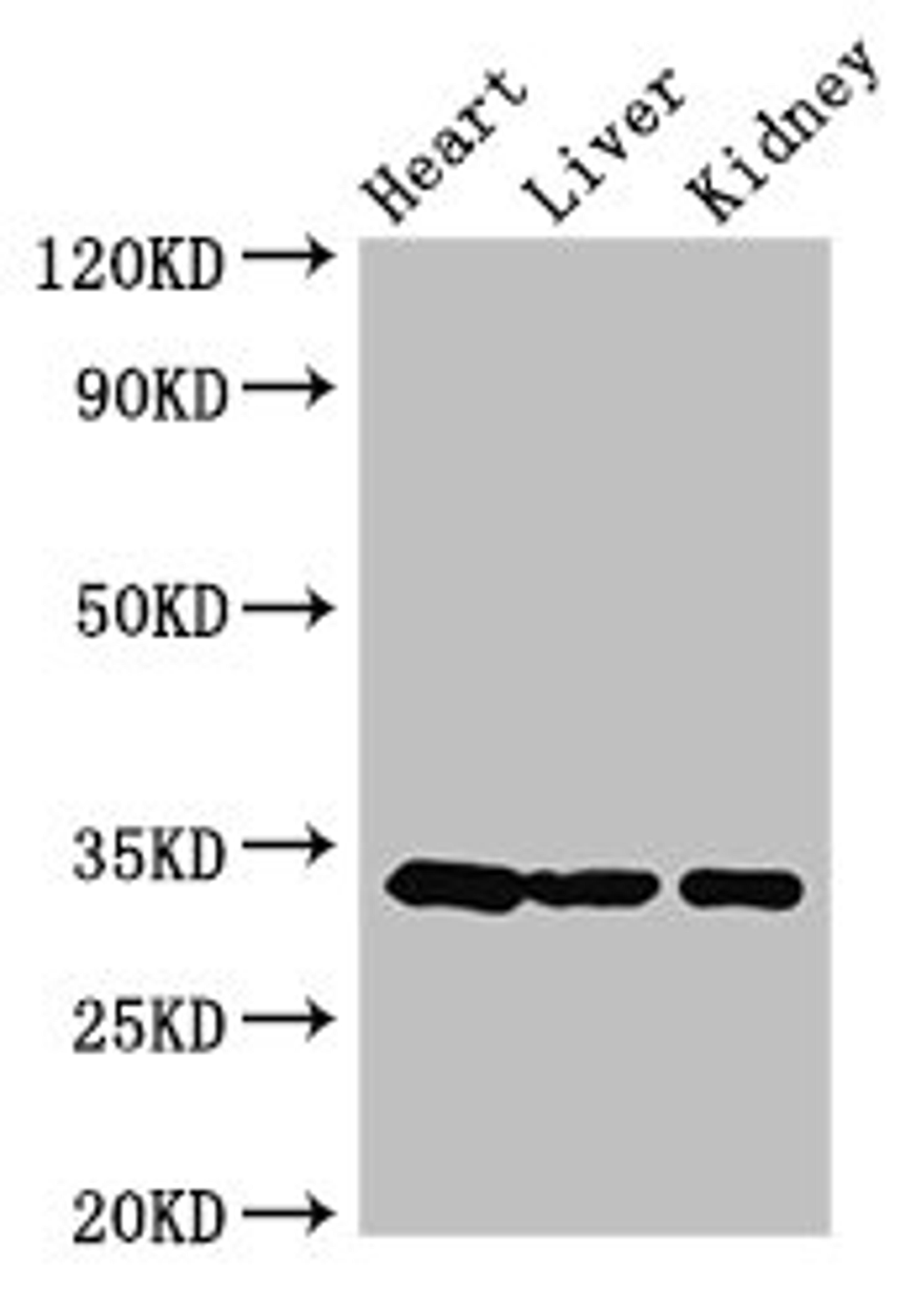 Western Blot. Positive WB detected in: Mouse heart tissue, Mouse liver tissue, Mouse kidney tissue. All lanes: CCND2 antibody at 3.5ug/ml. Secondary. Goat polyclonal to rabbit IgG at 1/50000 dilution. Predicted band size: 34, 25 kDa. Observed band size: 34 kDa. 