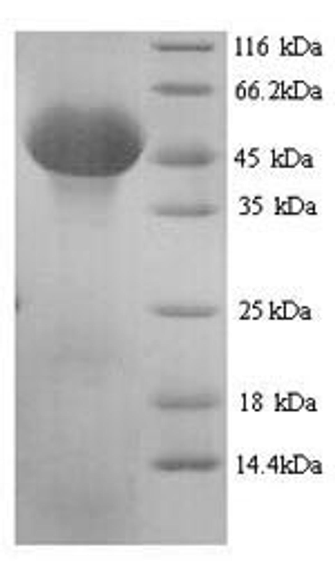 (Tris-Glycine gel) Discontinuous SDS-PAGE (reduced) with 5% enrichment gel and 15% separation gel.