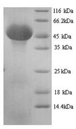 (Tris-Glycine gel) Discontinuous SDS-PAGE (reduced) with 5% enrichment gel and 15% separation gel.