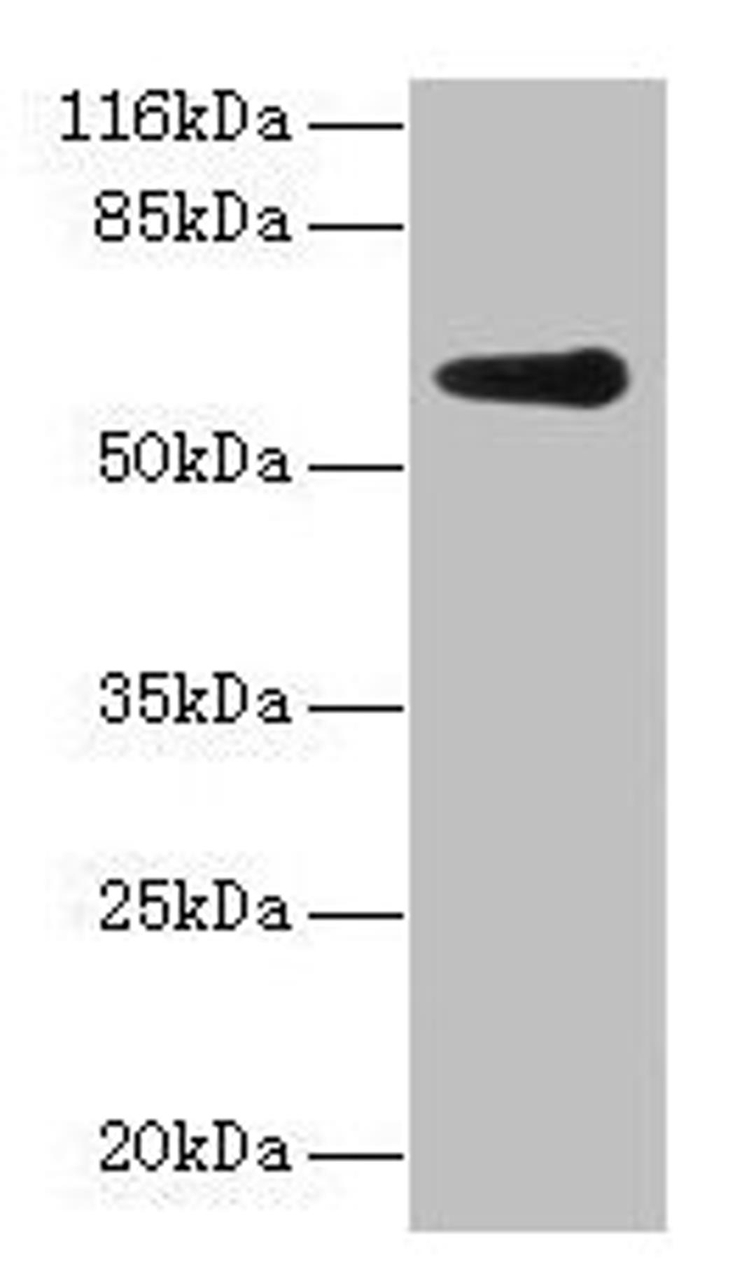 Western blot. All lanes: GK2 antibody at 2µg/ml + Jurkat whole cell lysate. Secondary. Goat polyclonal to rabbit IgG at 1/10000 dilution. Predicted band size: 61 kDa. Observed band size: 61 kDa