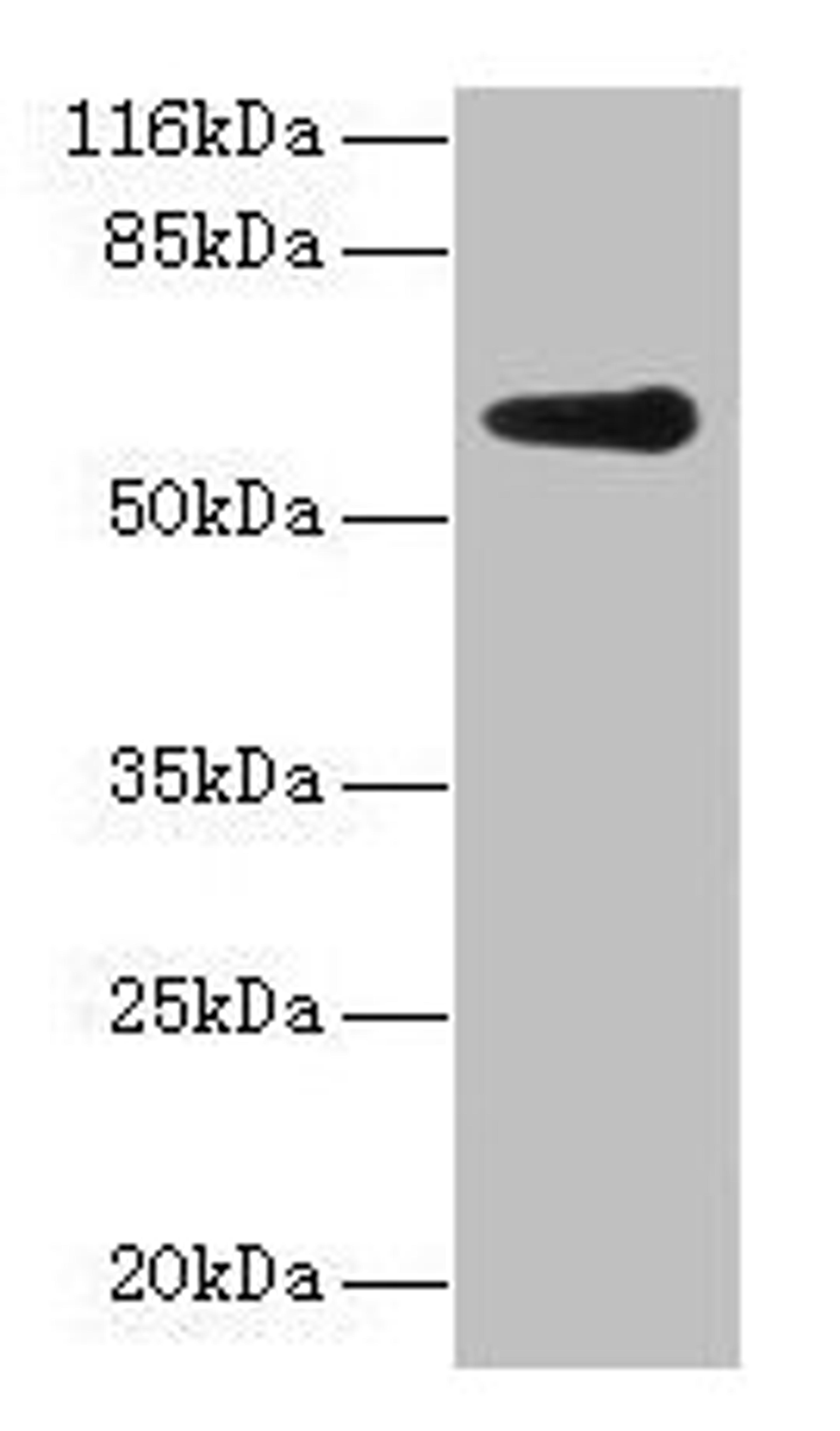 Western blot. All lanes: GK2 antibody at 2µg/ml + Jurkat whole cell lysate. Secondary. Goat polyclonal to rabbit IgG at 1/10000 dilution. Predicted band size: 61 kDa. Observed band size: 61 kDa