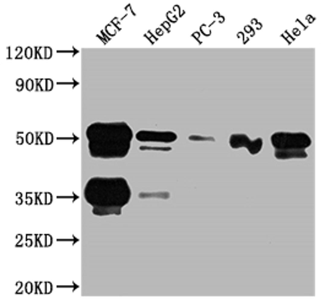 Western Blot. Positive WB detected in: MCF-7 whole cell lysate, HepG2 whole cell lysate, PC-3 whole cell lysate, 293 whole cell lysate, Hela whole cell lysate. All lanes: FOXA1 antibody at 1:2000. Secondary. Goat polyclonal to rabbit IgG at 1/50000 dilution. Predicted band size: 50, 46 kDa. Observed band size: 50 kDa. 