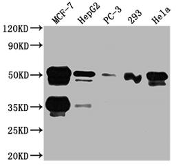 Western Blot. Positive WB detected in: MCF-7 whole cell lysate, HepG2 whole cell lysate, PC-3 whole cell lysate, 293 whole cell lysate, Hela whole cell lysate. All lanes: FOXA1 antibody at 1:2000. Secondary. Goat polyclonal to rabbit IgG at 1/50000 dilution. Predicted band size: 50, 46 kDa. Observed band size: 50 kDa.