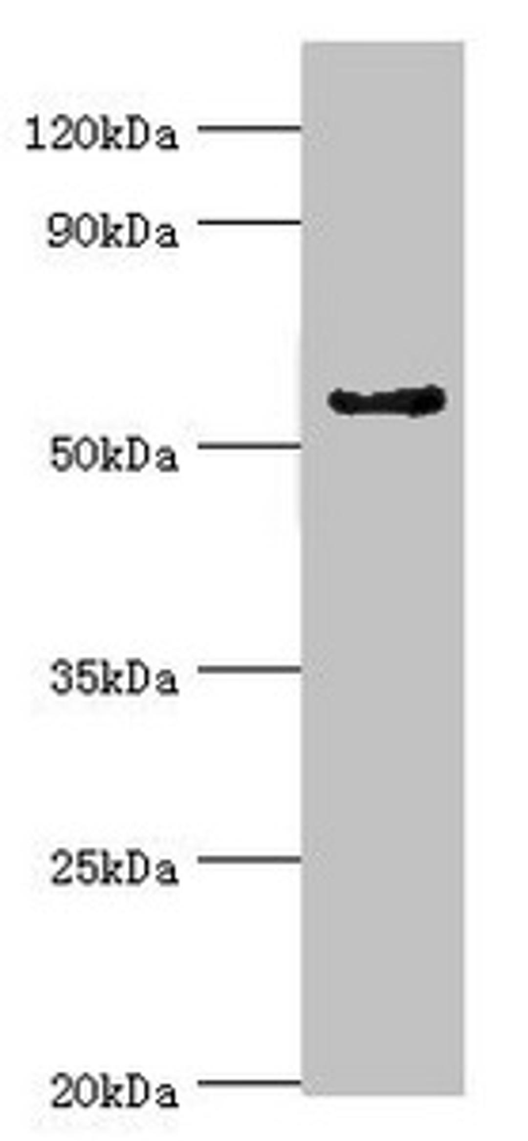 Western blot. All lanes: Cytochrome P450 3A5 antibody at 9ug/ml + Mouse liver tissue. Secondary. Goat polyclonal to rabbit IgG at 1/10000 dilution. Predicted band size: 58, 16 kDa. Observed band size: 58 kDa. 