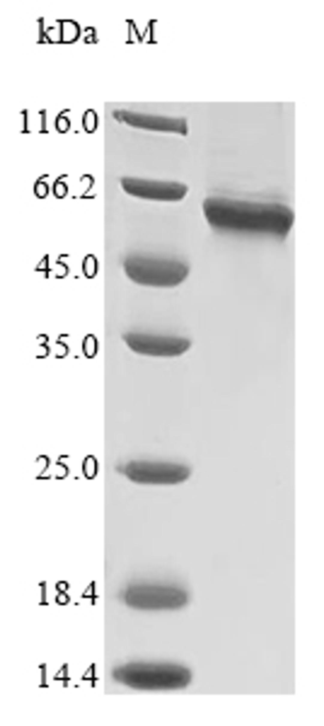 (Tris-Glycine gel) Discontinuous SDS-PAGE (reduced) with 5% enrichment gel and 15% separation gel.