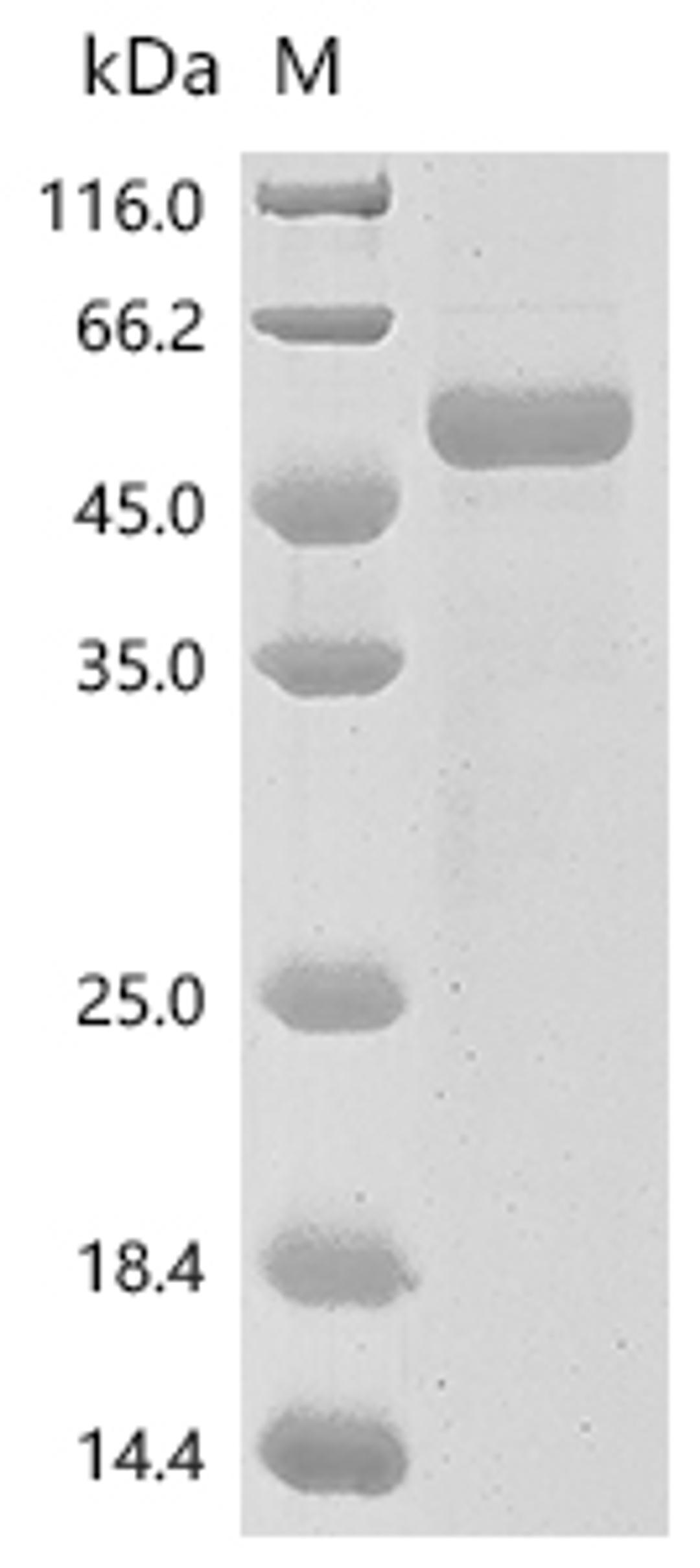 (Tris-Glycine gel) Discontinuous SDS-PAGE (reduced) with 5% enrichment gel and 15% separation gel.