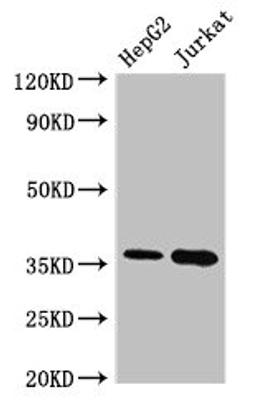 Western Blot. Positive WB detected in: HepG2 whole cell lysate, Jurkat whole cell lysate. All lanes: TYMS antibody at 2.4µg/ml. Secondary. Goat polyclonal to rabbit IgG at 1/50000 dilution. Predicted band size: 36, 32, 27 kDa. Observed band size: 36 kDa