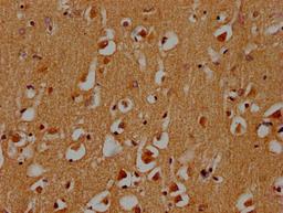 IHC image of CSB-PA722568LA01HU diluted at 1:300 and staining in paraffin-embedded human brain tissue performed on a Leica BondTM system. After dewaxing and hydration, antigen retrieval was mediated by high pressure in a citrate buffer (pH 6.0). Section was blocked with 10% normal goat serum 30min at RT. Then primary antibody (1% BSA) was incubated at 4°C overnight. The primary is detected by a biotinylated secondary antibody and visualized using an HRP conjugated SP system.